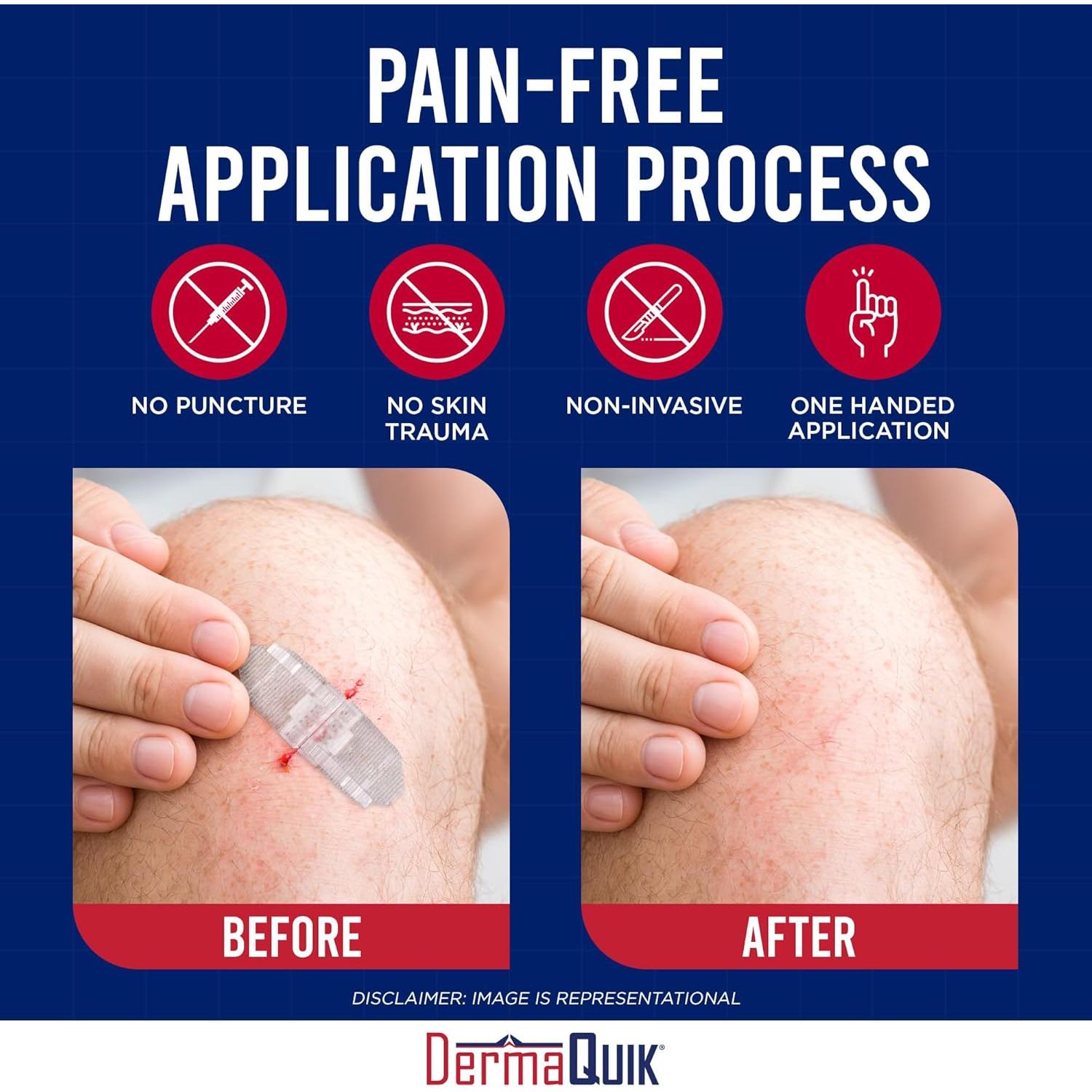 Tiras de Cierre de Heridas DermaQuik - Paquete de 3 Unidades