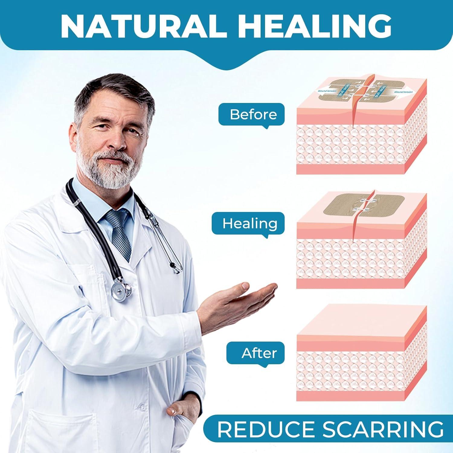 Tiras de Cierre de Heridas GZXOCIU - Kit de 2 Unidades