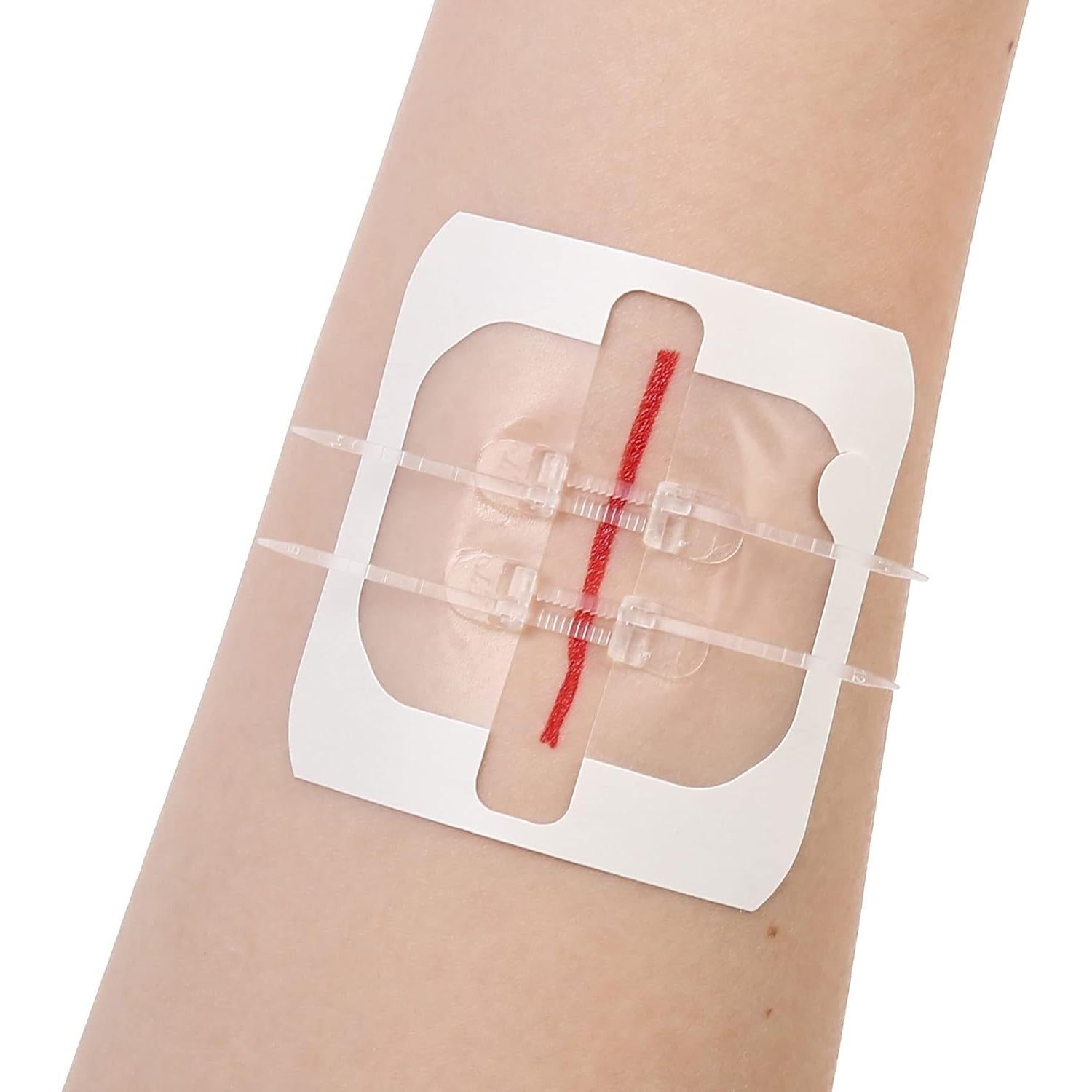 Cierres de Heridas LotFancy 4 Unidades Estériles Primeros Auxilios