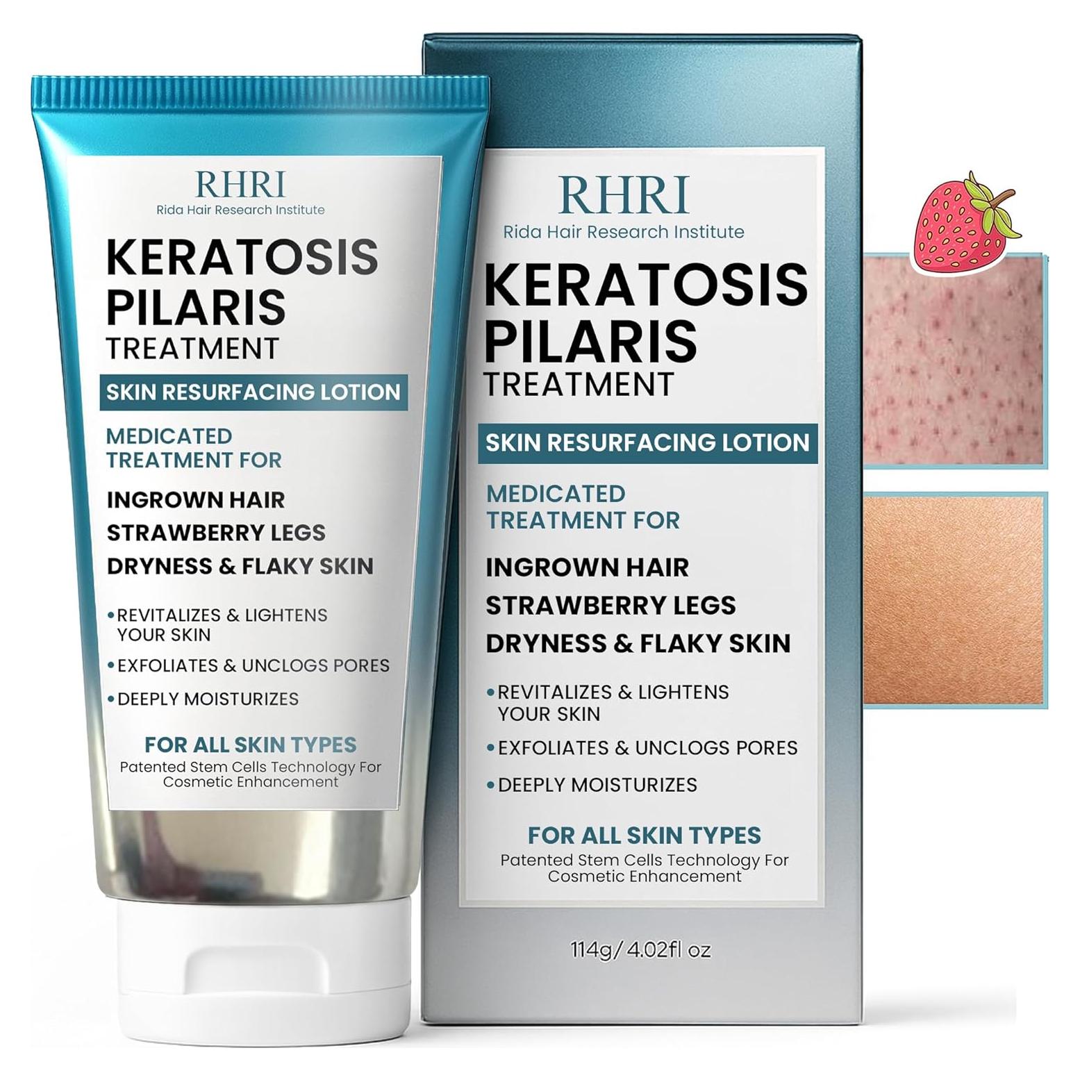 Loción Corporal Exfoliante KP 132g - Tratamiento Queratosis Pilaris