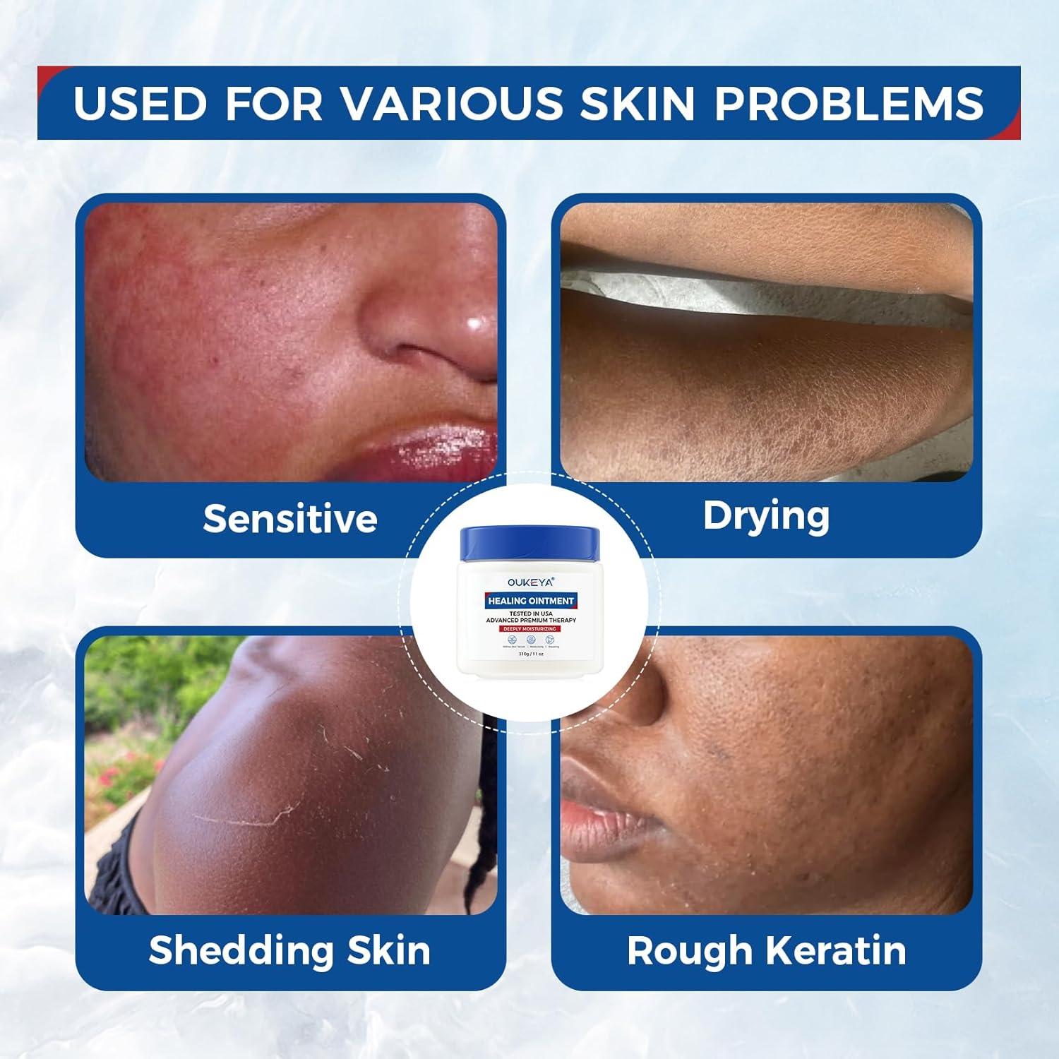 Ungüento Curativo OUKEYA 155g x 2, Hidratante Piel Seca y Agrietada