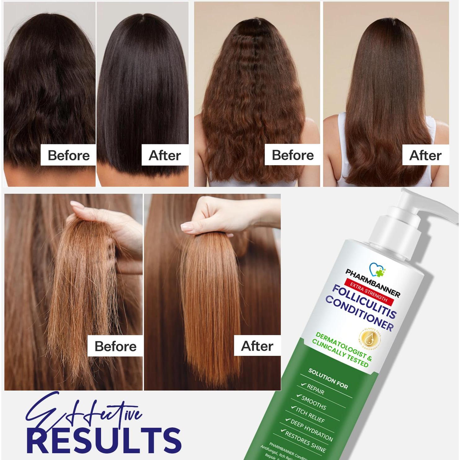 Acondicionador PHARMBANNER 335 g - Alivio Picazón Foliculitis