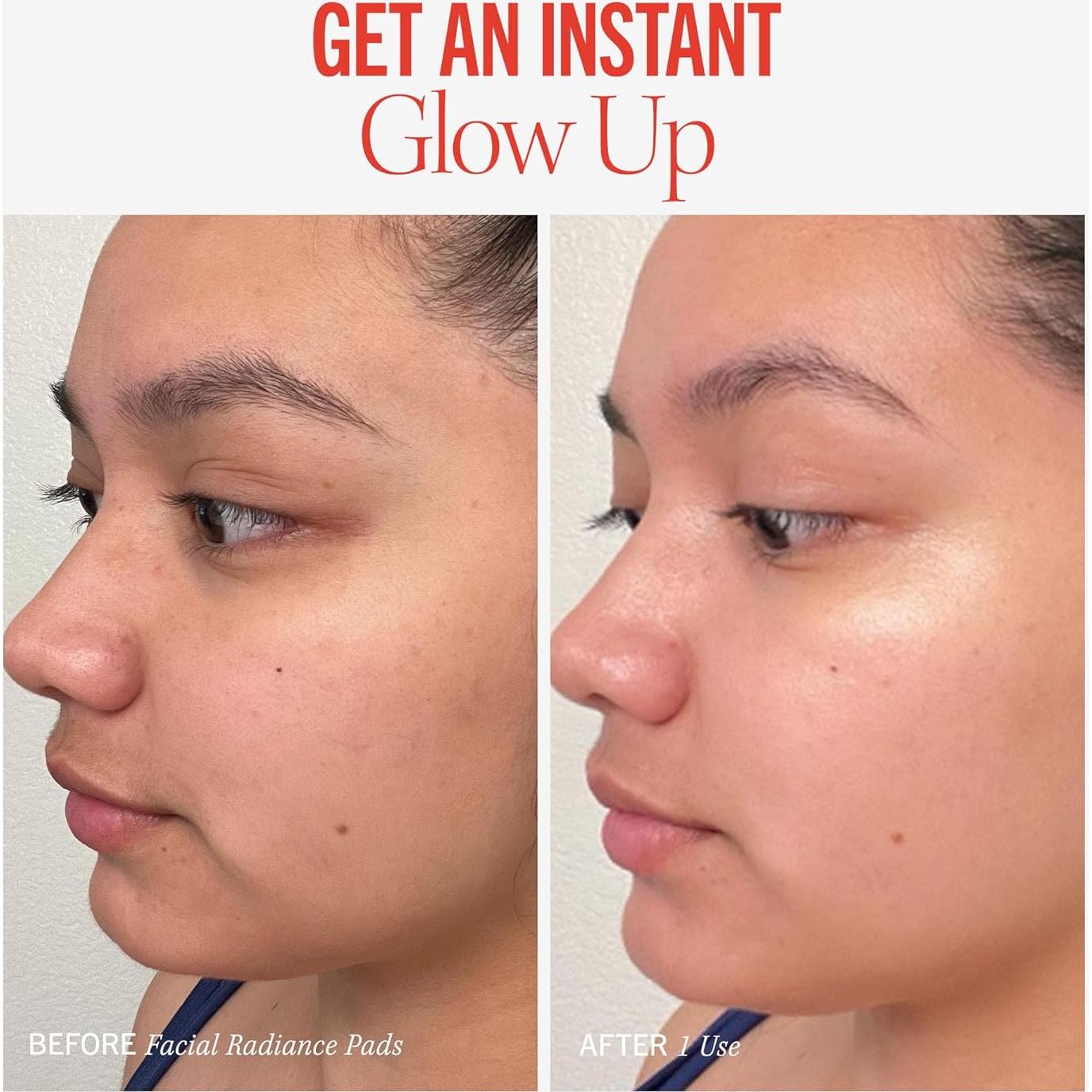 Almohadillas Exfoliantes Faciales First Aid Beauty 28 Unidades