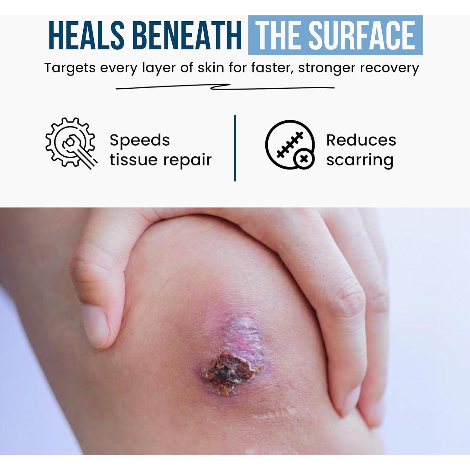 Suplemento de Colágeno Cuidado de Heridas Plus - 90 Cápsulas