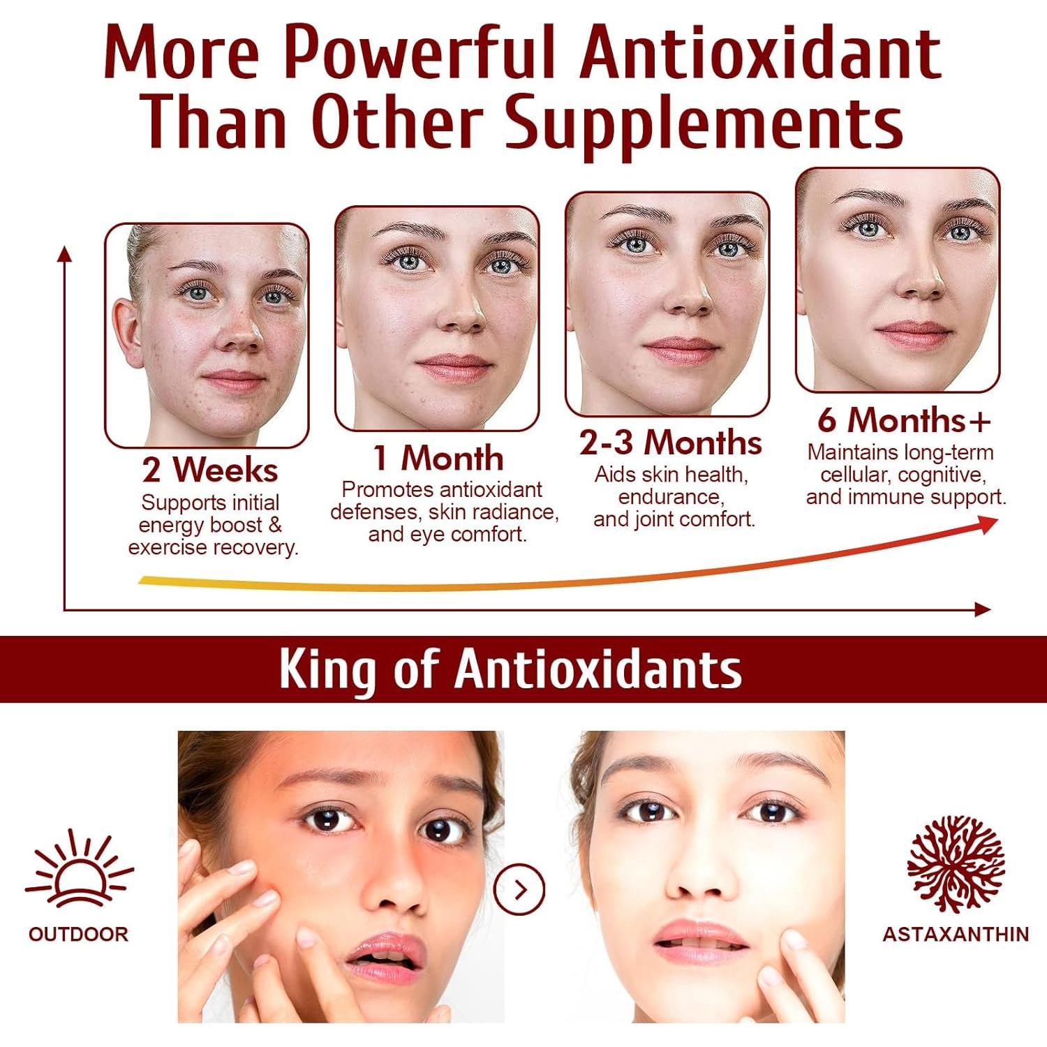 Suplemento de Astaxantina 12mg Ruduwu 120 Softgels Antioxidantes