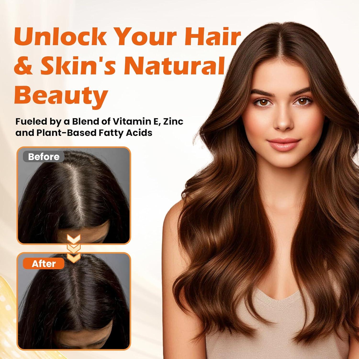 Aceite de Semilla de Calabaza 3000mg ORVAE Gelatinas Blandas