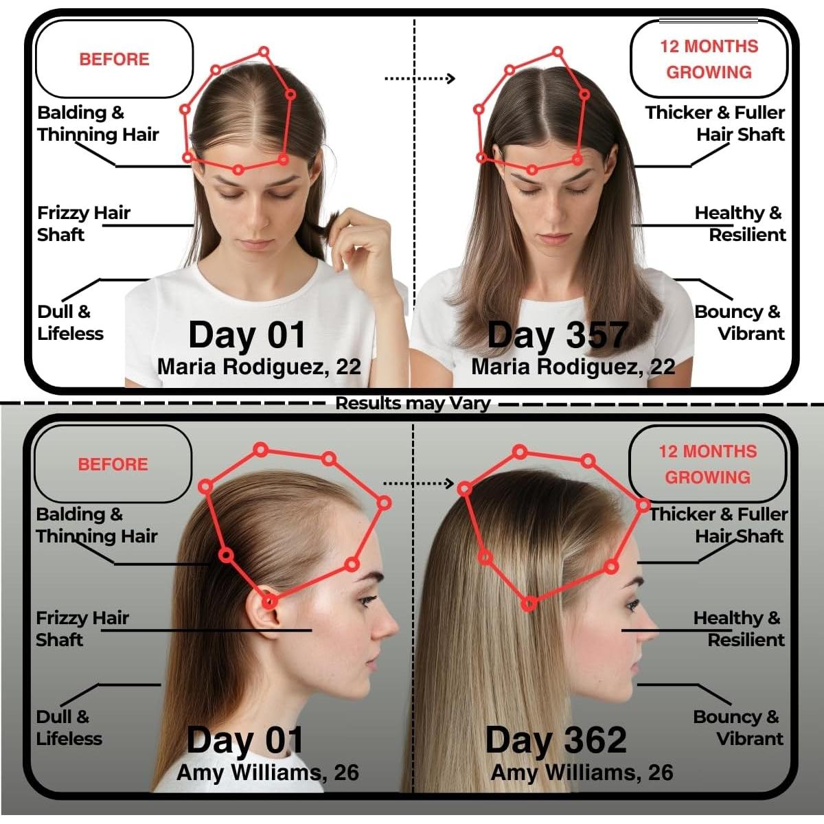 Gomitas de Biotina y Colágeno GummBear 5000mcg - 181g