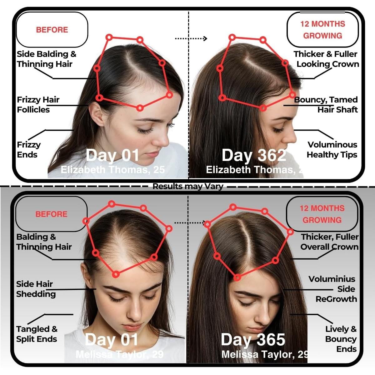 Gomitas de Biotina y Colágeno GummBear 5000mcg - 181g