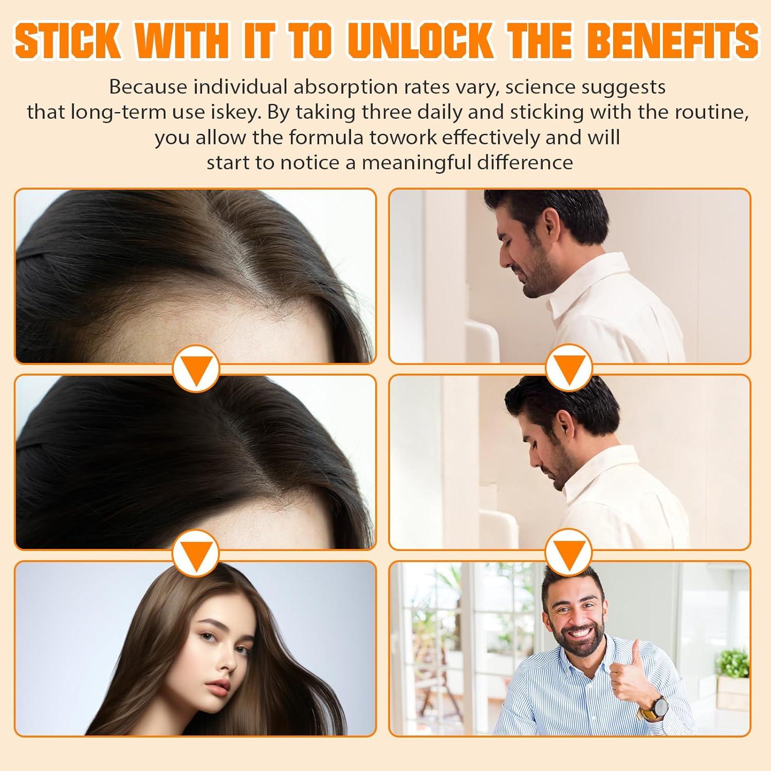 Cápsulas de Aceite de Semilla de Calabaza SXOSXO 1000mg 120 Softgels