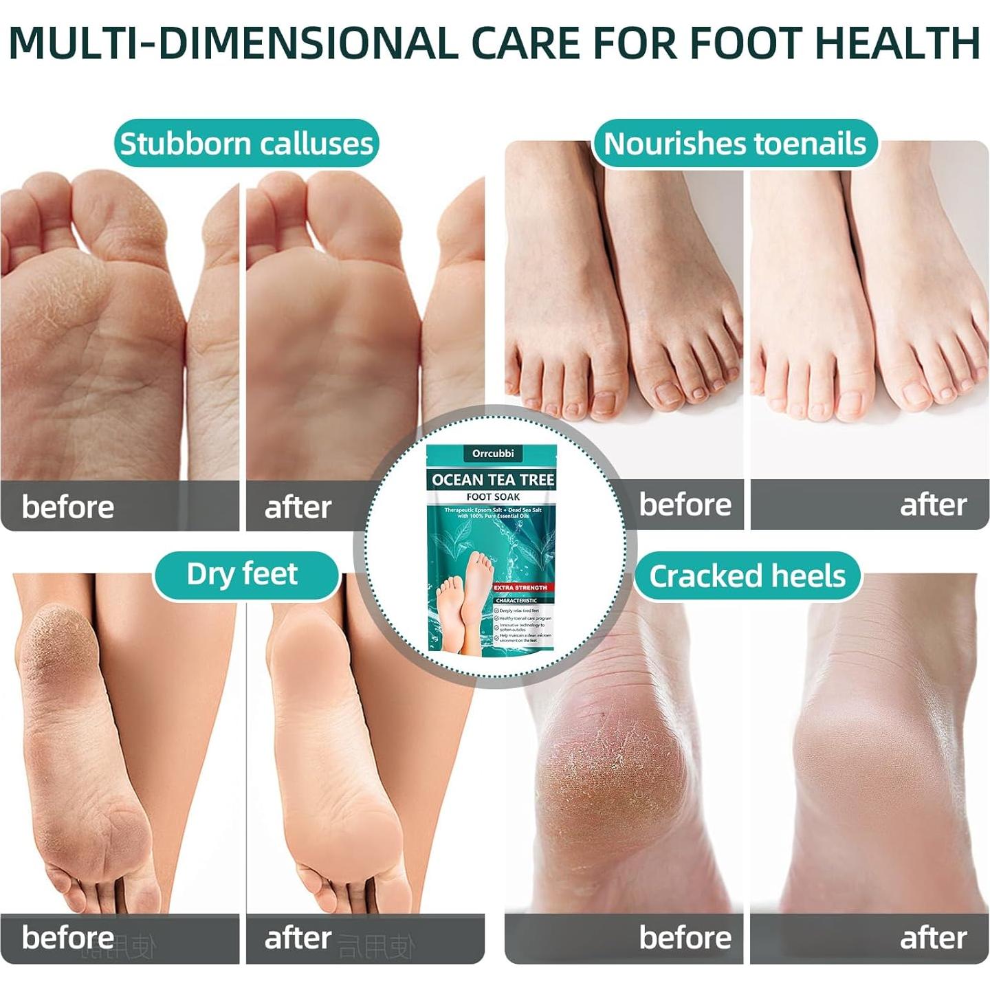 Sal de Baño para Pies Orrcubbi - Aceite de Árbol de Té 453g