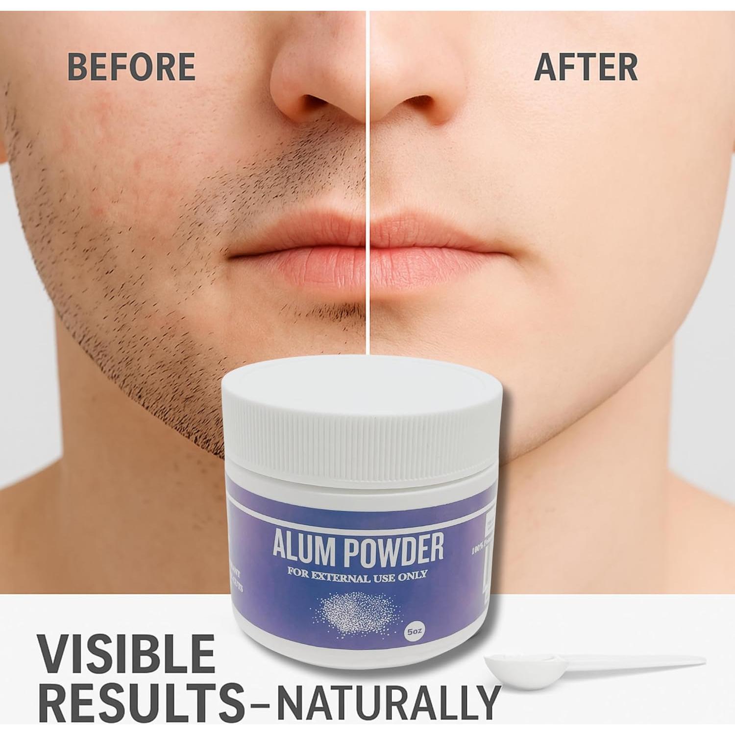 Polvo de Alumbre de Potasio 142g - Desodorante Natural G.B.S