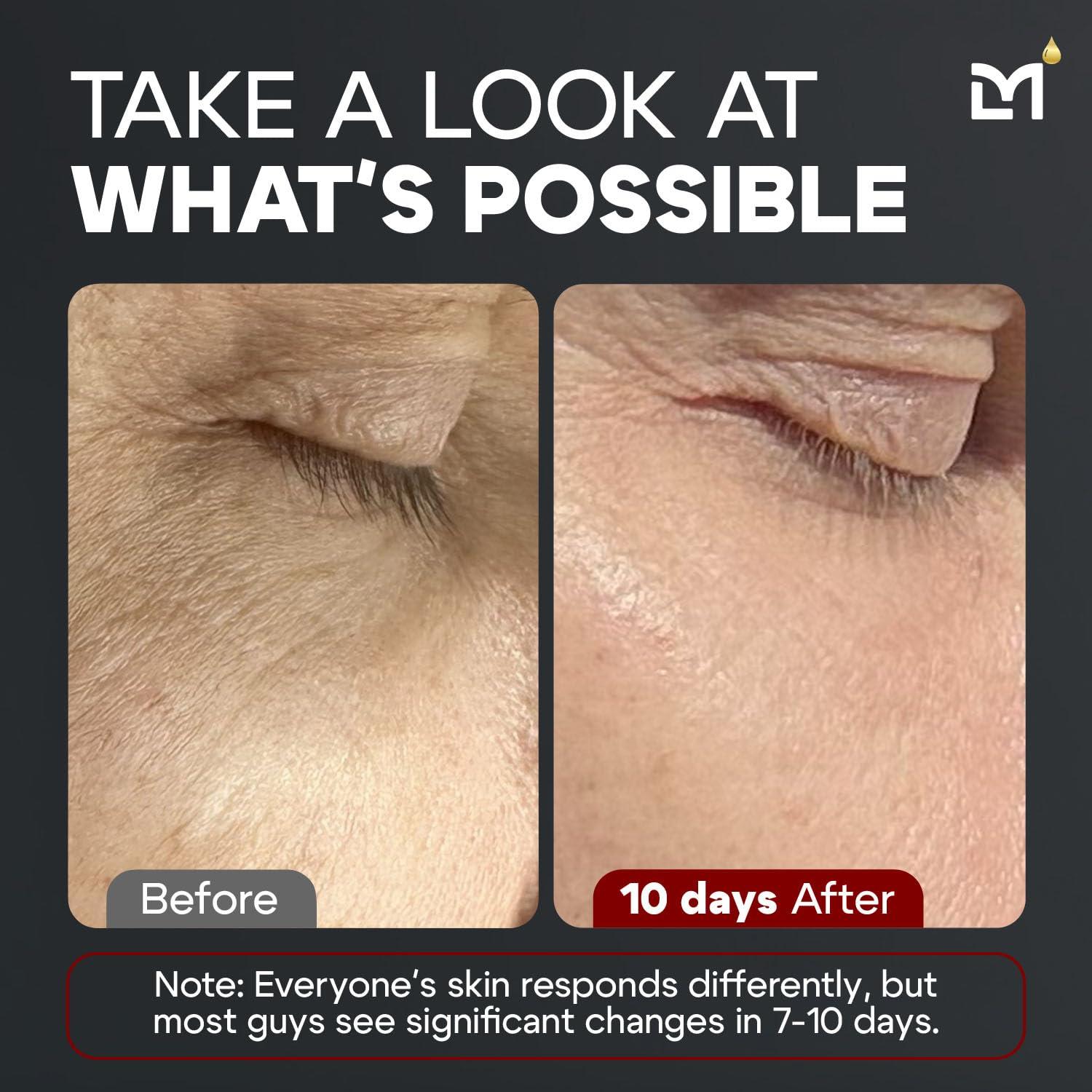 Sérum Facial Antienvejecimiento Titan Man Labs - 5% Niacinamida