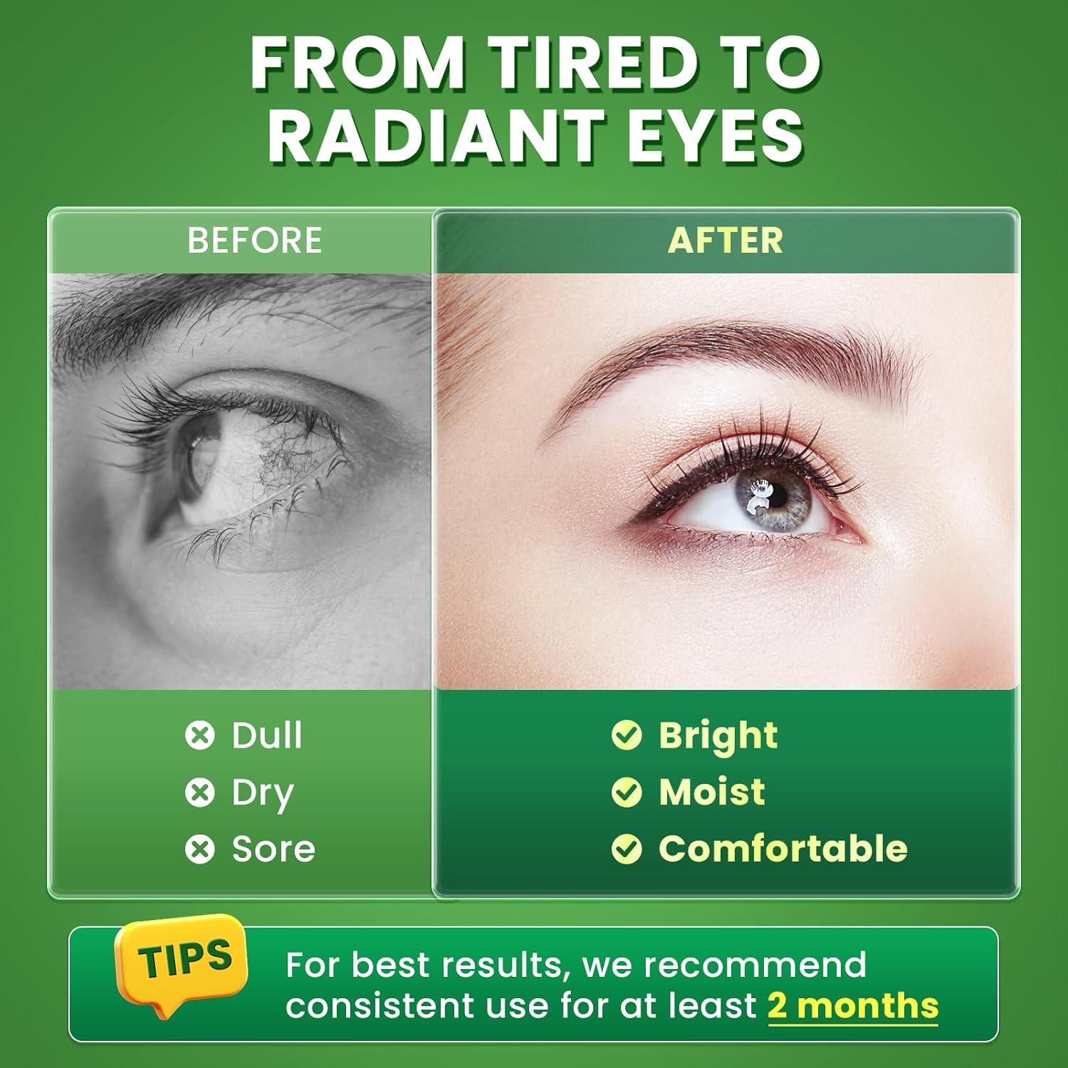 Suplemento Ocular Lukaree AREDS 2 - 60 Cápsulas con Luteína