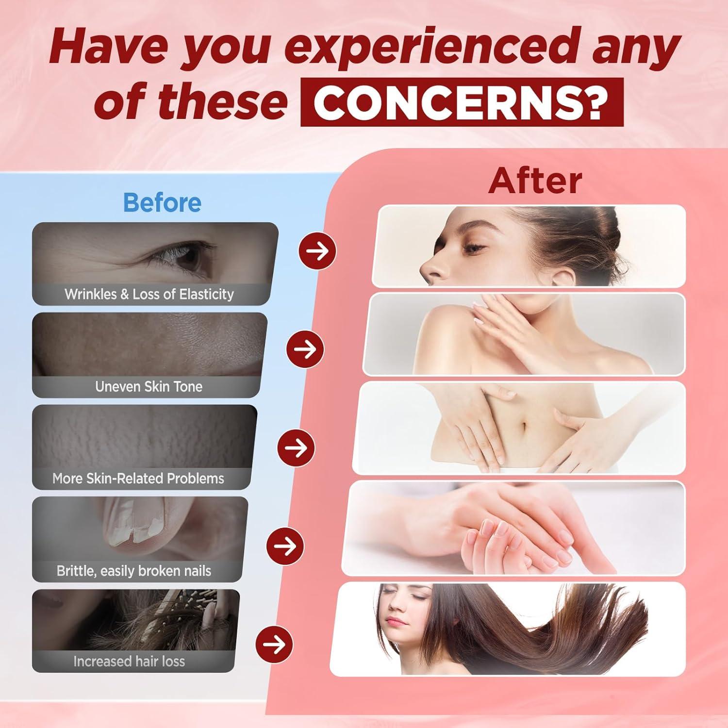 Gomitas de Colágeno Marino Natisland 2500 mg Sin Azúcar 60CT