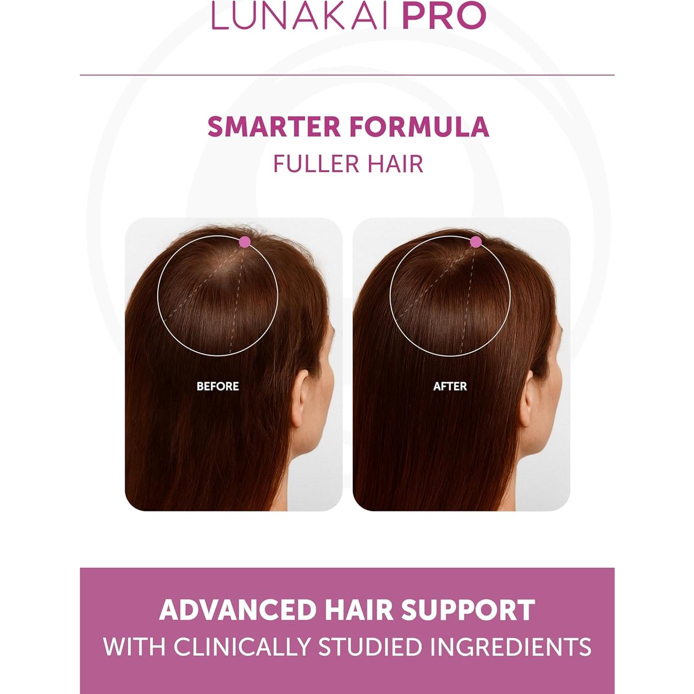 Vitaminas Lunakai PRO para Crecimiento Cabello Femenino 90 gomitas