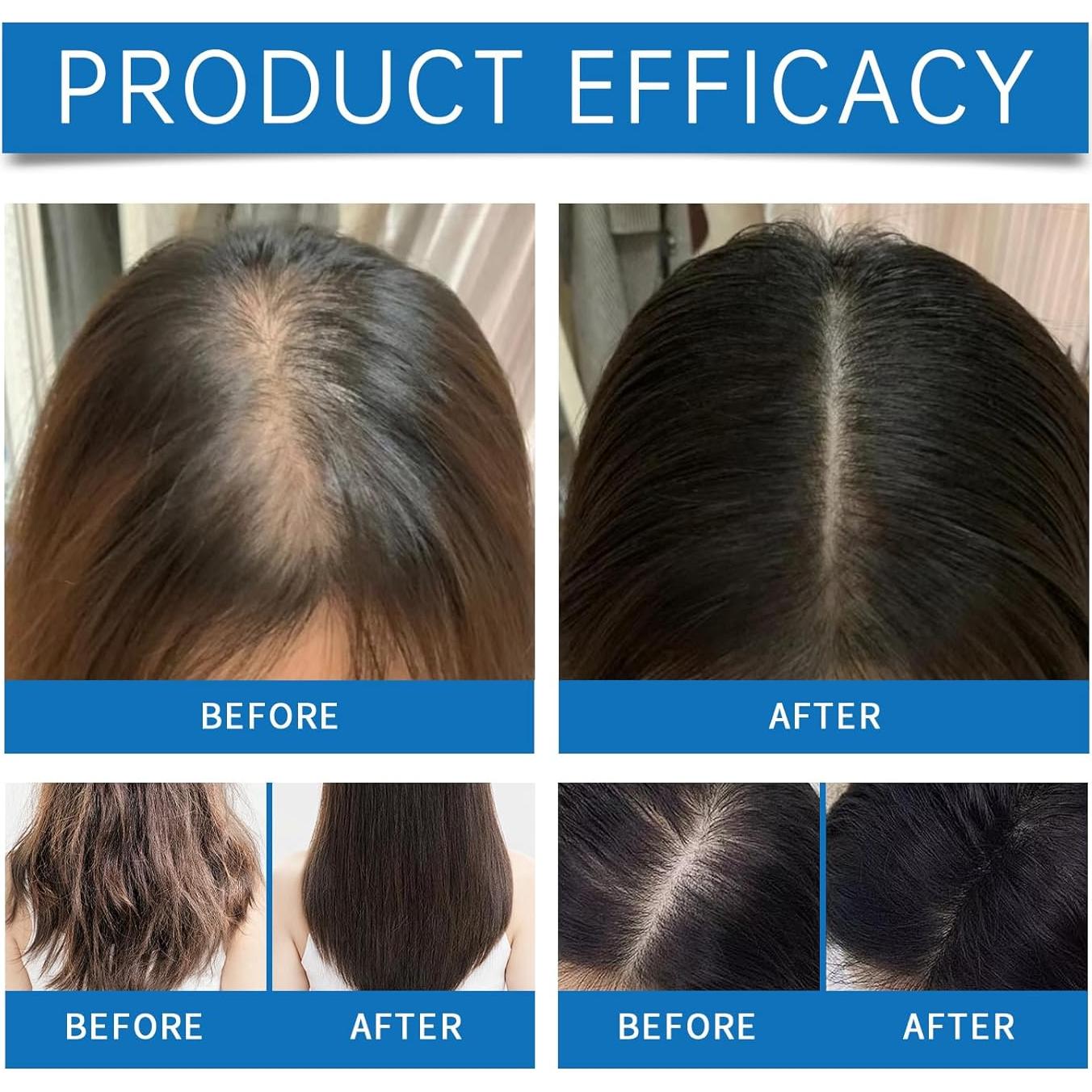 Suero Nutritivo para el Crecimiento del Cabello Romero 25ml