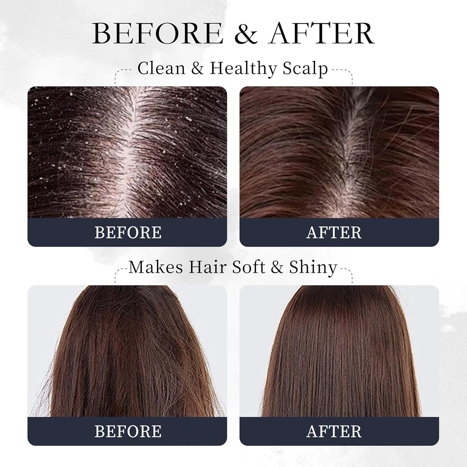 Aceite de Romero Novastile 132g - Tratamiento Cabello y Cuero Cabelludo