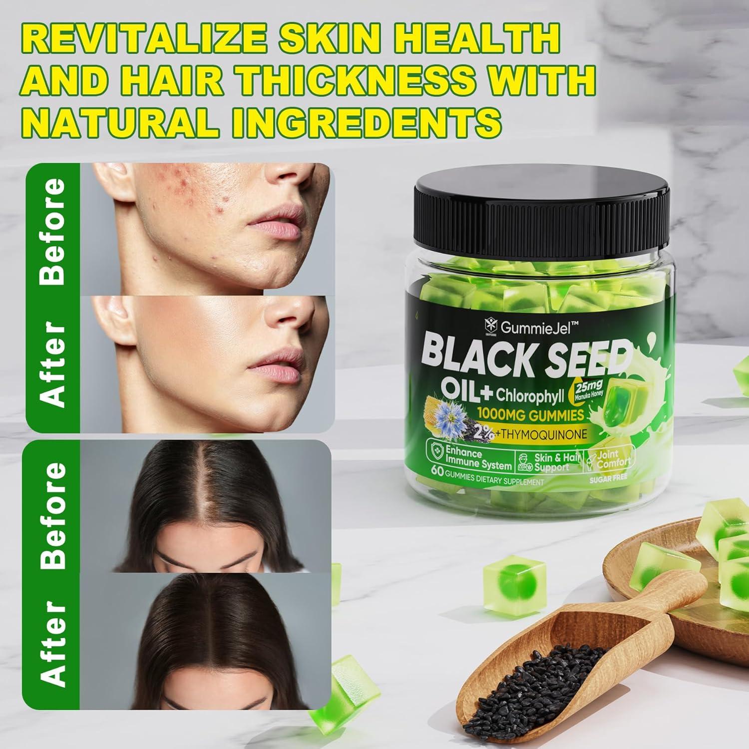 Gomitas de Aceite de Semilla Negra EnvyCure 60 Unidades - Colágeno, Biotina