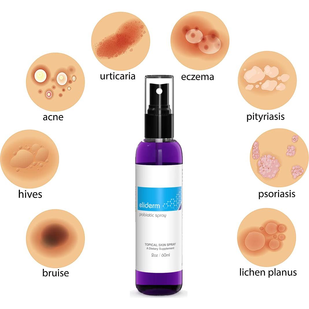 Spray Probiotico Eliderm para Piel - 13 Cepas Vivas 45g