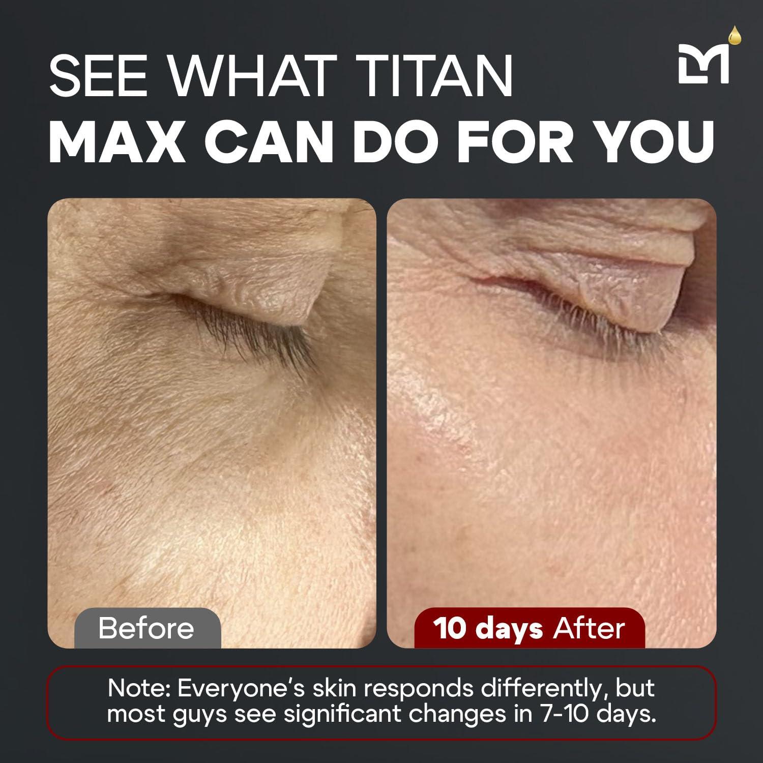Suero Facial Anti-Envejecimiento Titan MAX para Hombres - 10% Niacinamida, Ácido Hialurónico
