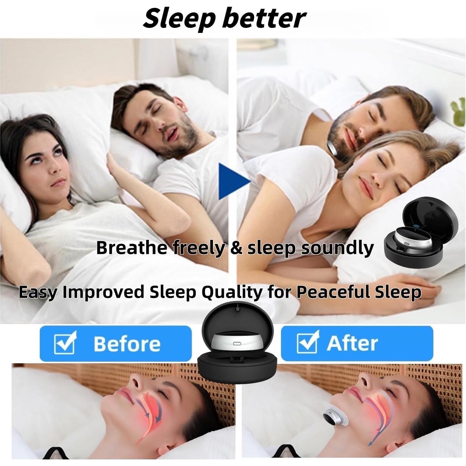 Dispositivo Antironquidos Donpidd Z3 Pro - 3 Niveles Ajustables