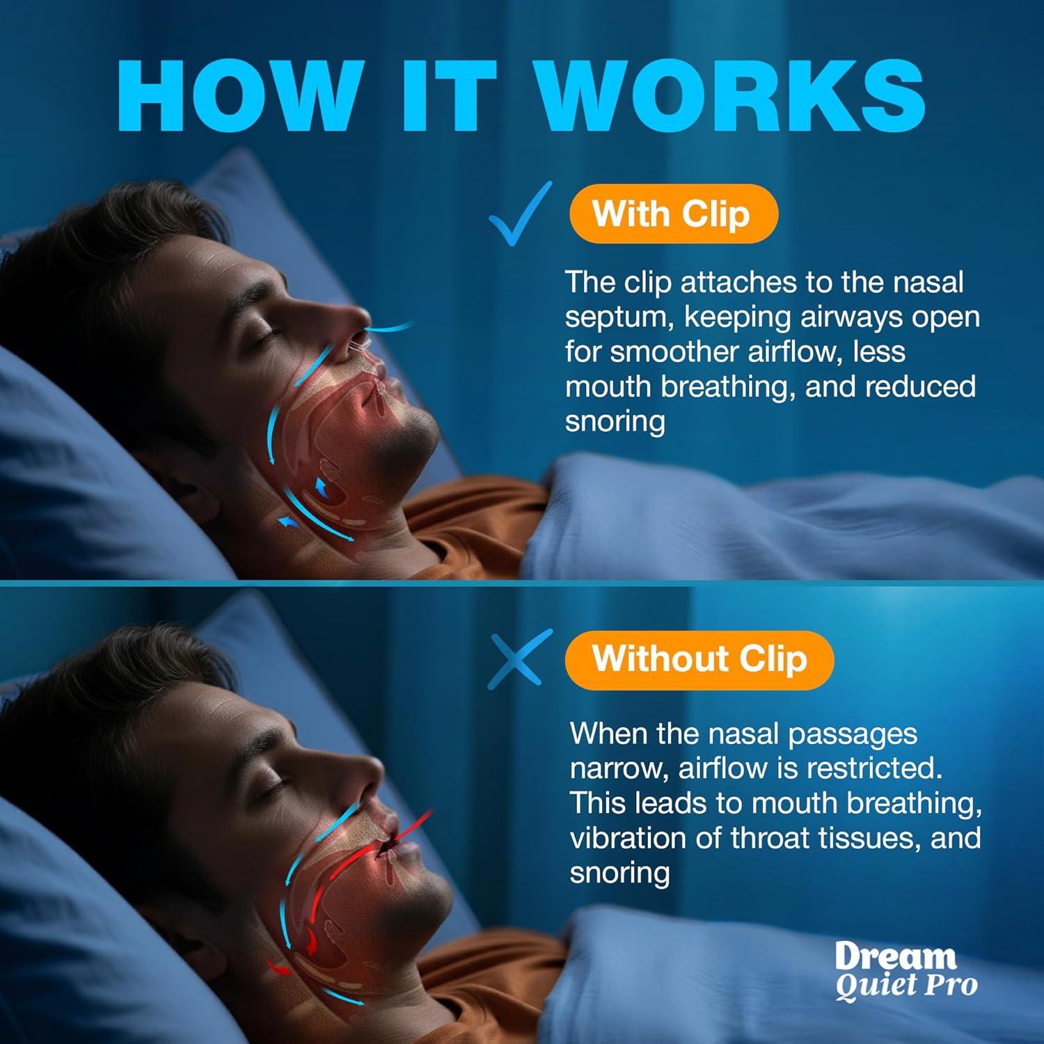 Clip Nasal Antisnores Magnético Commanding Life - 8 Pcs