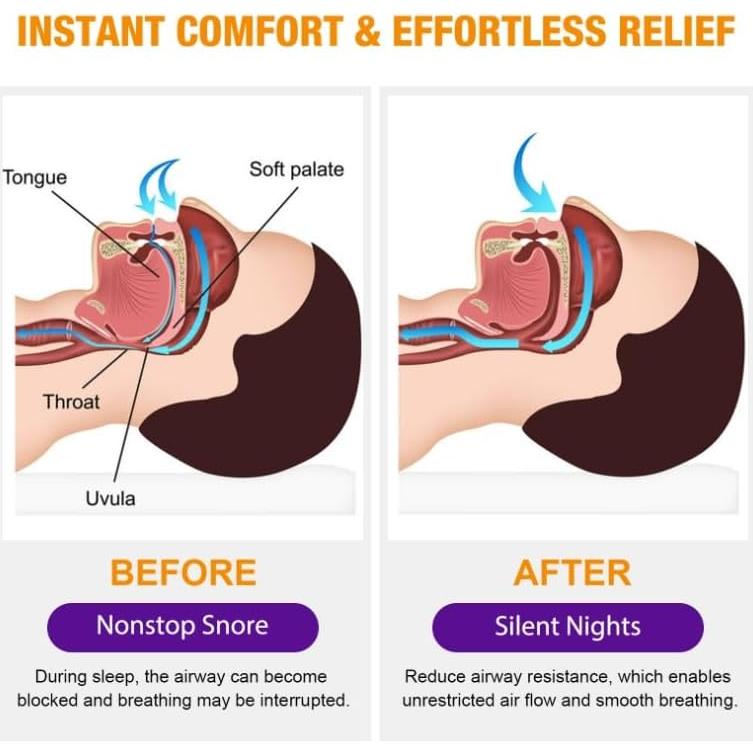 Spray Antisnoring JINZZHAO 30ml - Solución Natural para Ronquidos