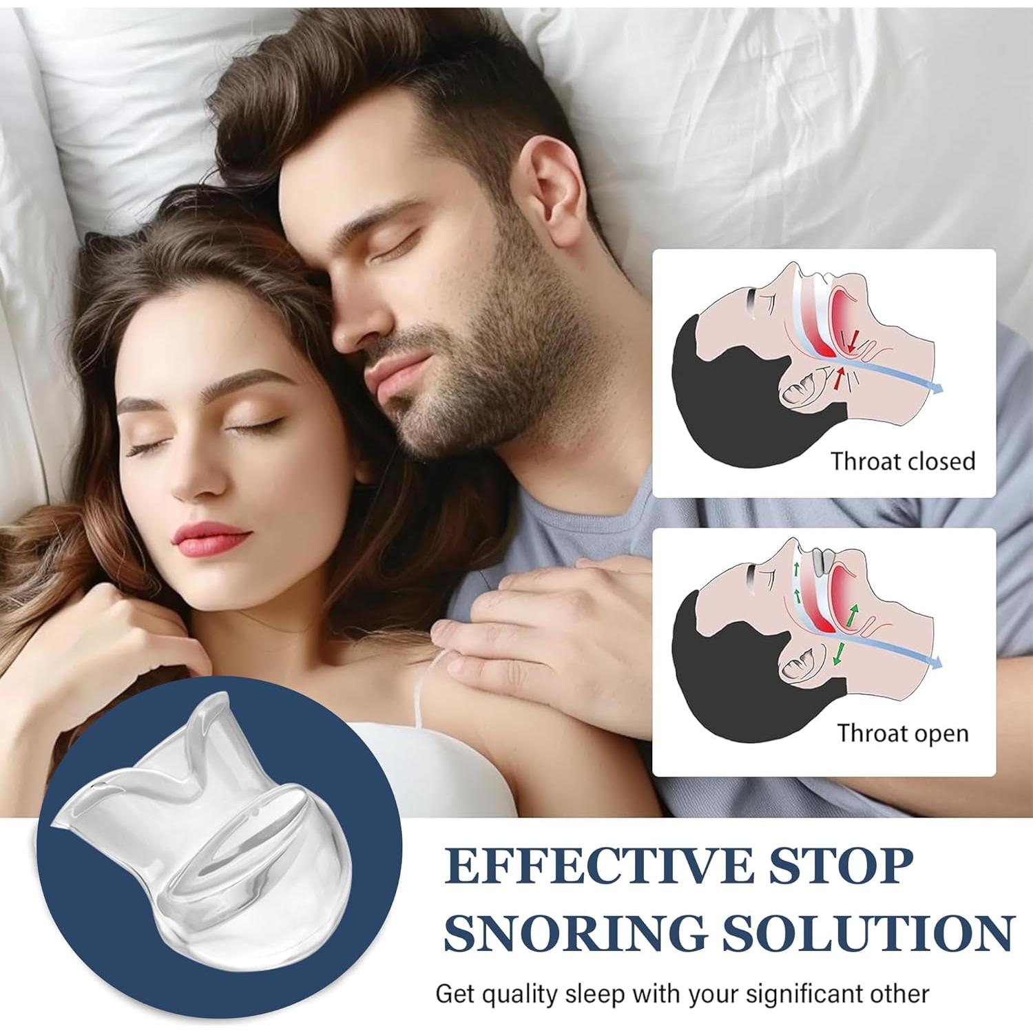 Dispositivo Antironquidos Bucal MFANBLAS - Protector para Sueño