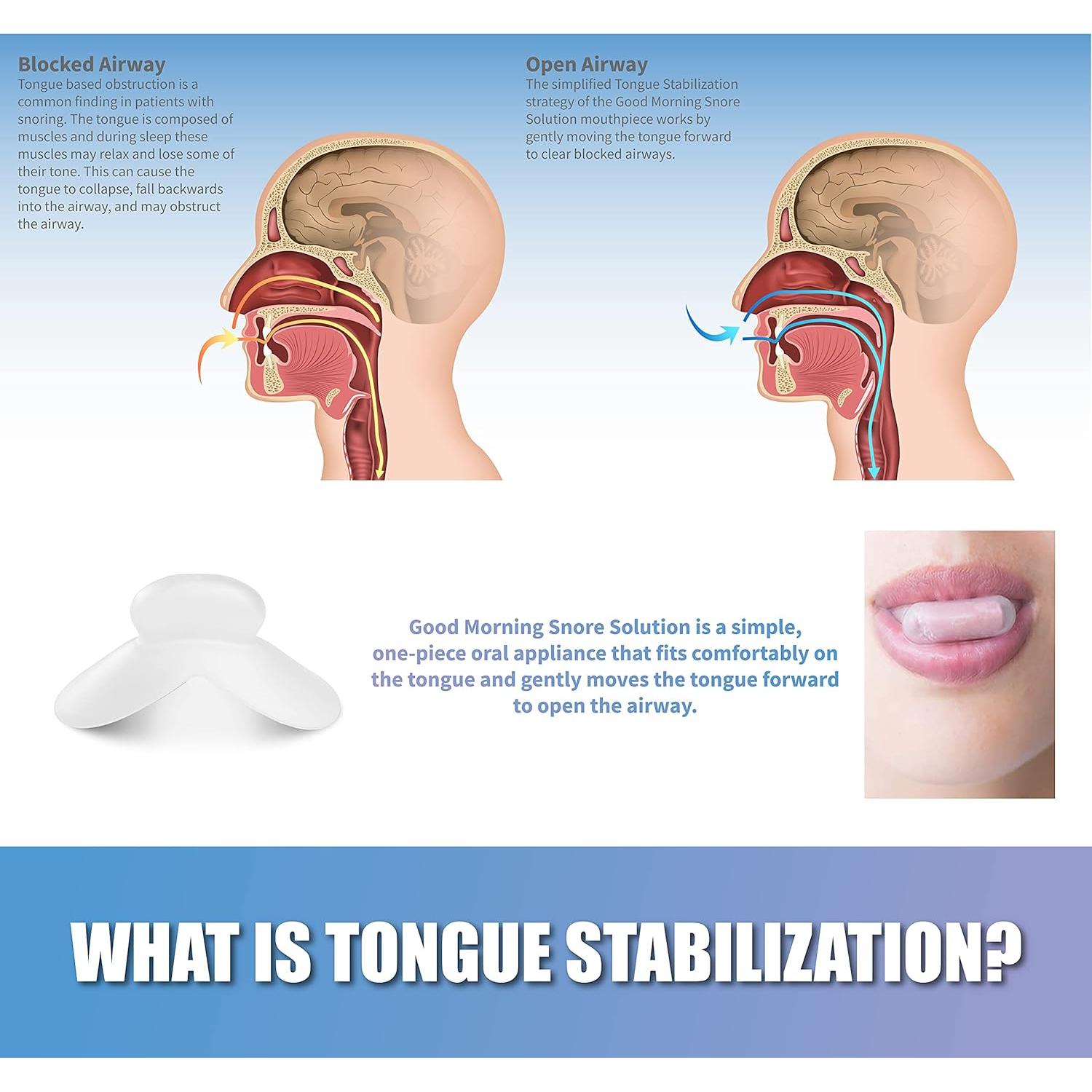 Dispositivo Antisnoring Good Morning - Protector Bucal Nocturno