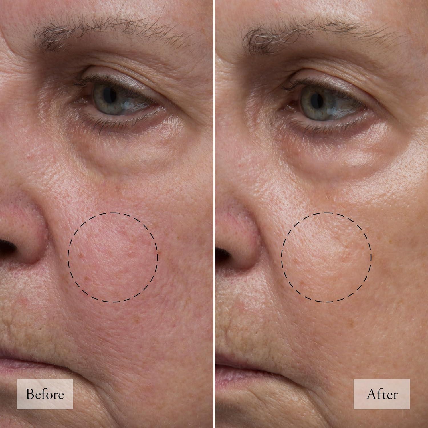 Conjunto de Cuidado de Piel Philosophy Esperanza Mini 68g