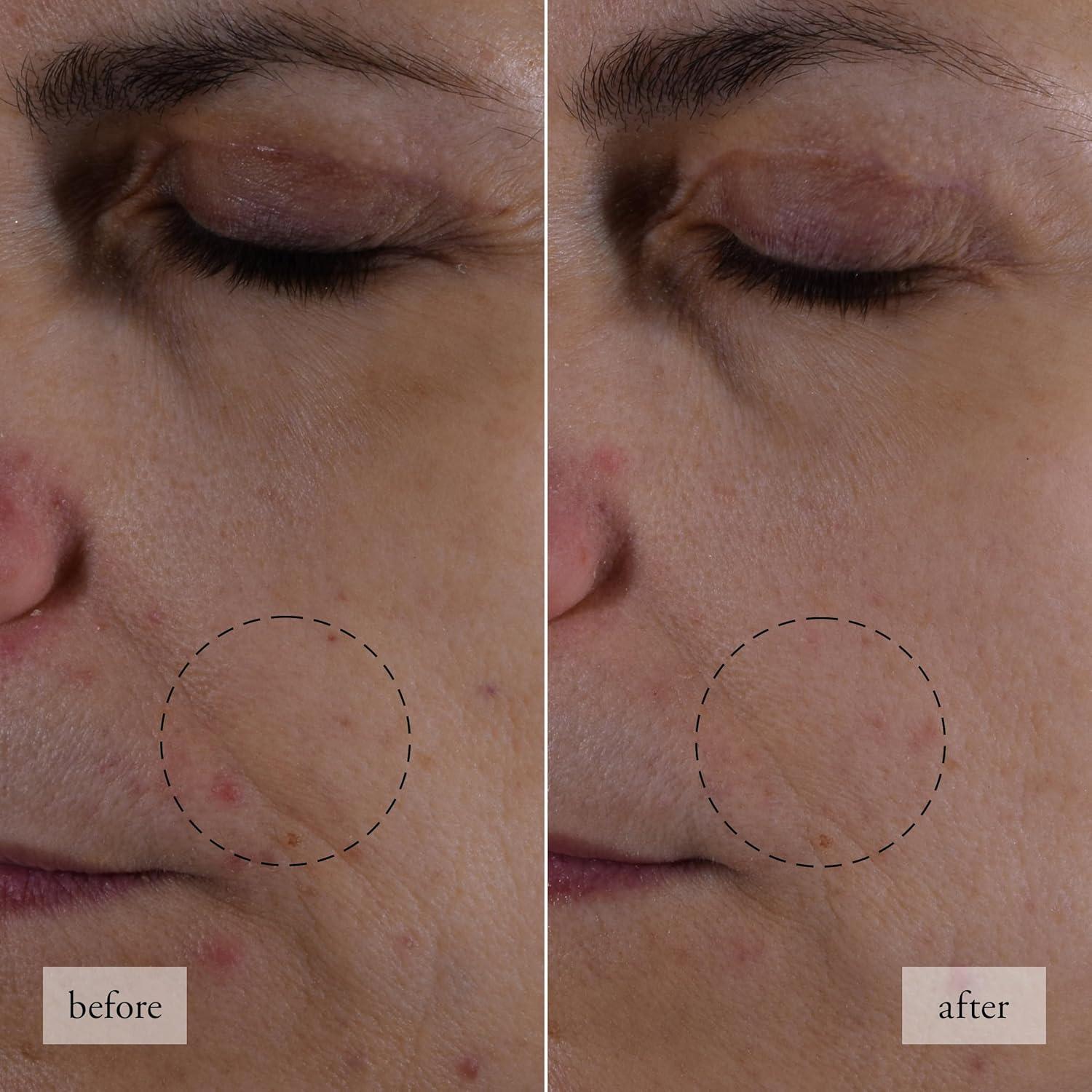 Conjunto de Cuidado de Piel Philosophy Esperanza Mini 68g