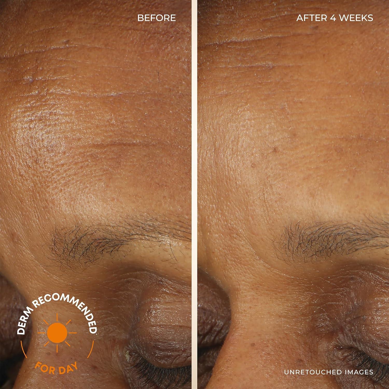 Paquete Cuidado Facial RoC Retinol Correxion 2 Crema Antiarrugas