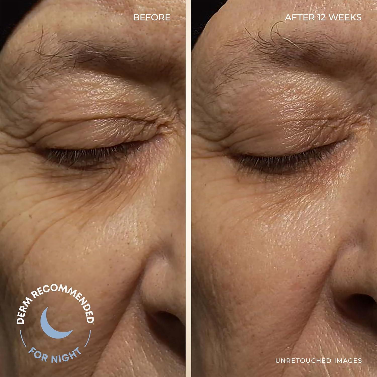 Paquete Cuidado Facial RoC Retinol Correxion 2 Crema Antiarrugas