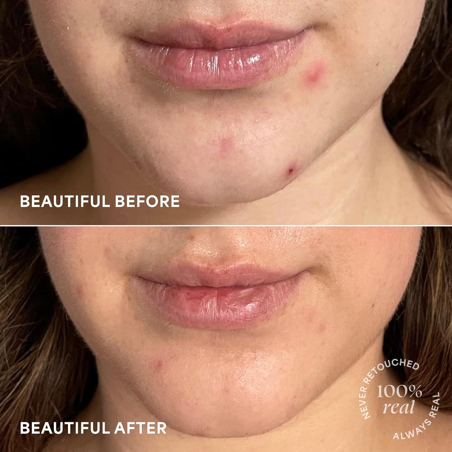 Kit Mini de Cuidado de la Piel TULA - 4 Piezas