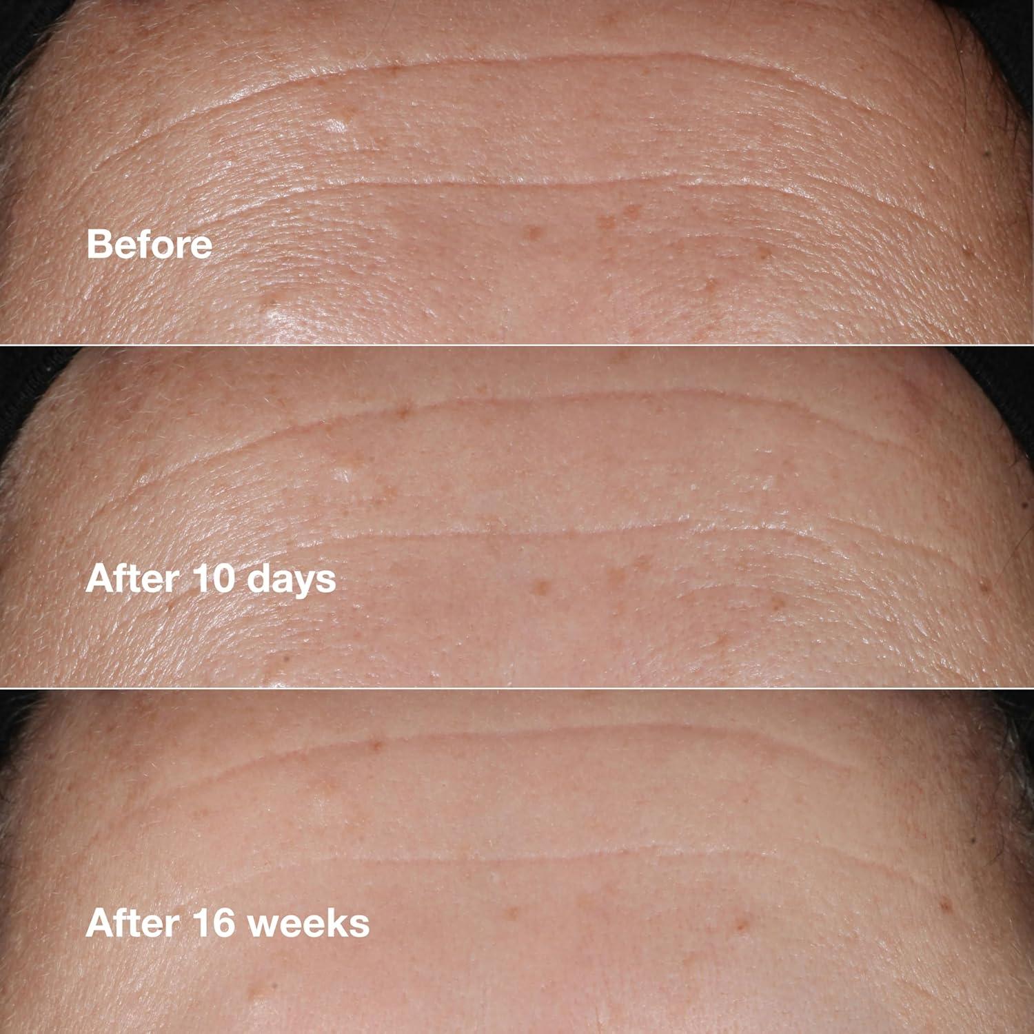 Suero Anti Envejecimiento Clinique Smart Clinical Repair 10 ml