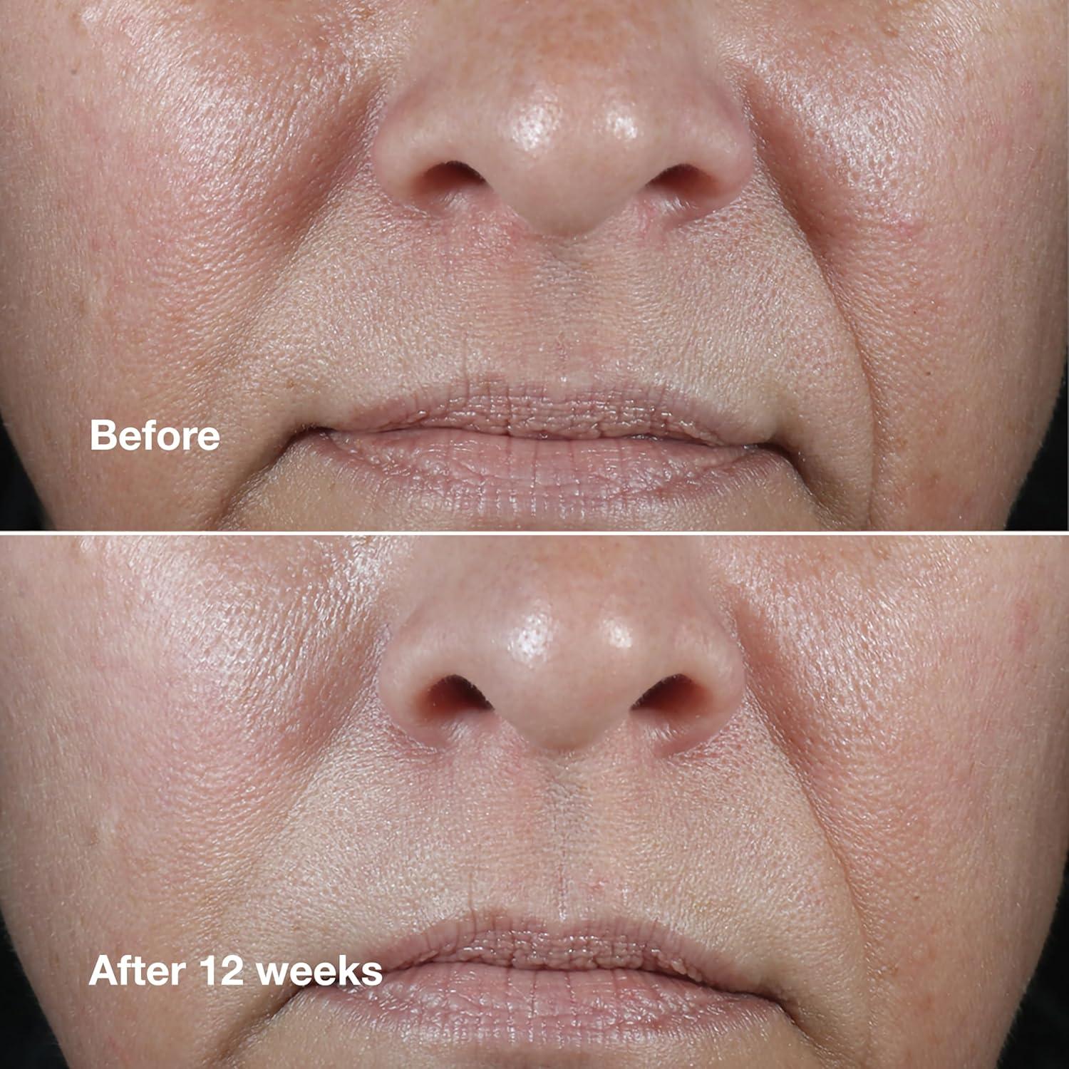 Crema Anti-Envejecimiento Clinique Smart Clinical Repair 50 ml