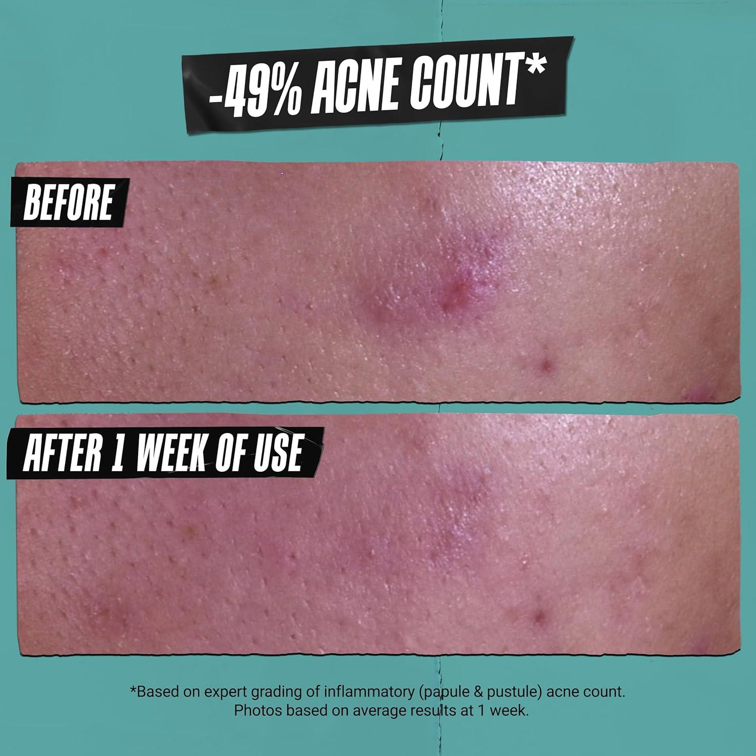 Pasta Limpiadora Tratante Kiehl's 124 ml Ácido Salicílico