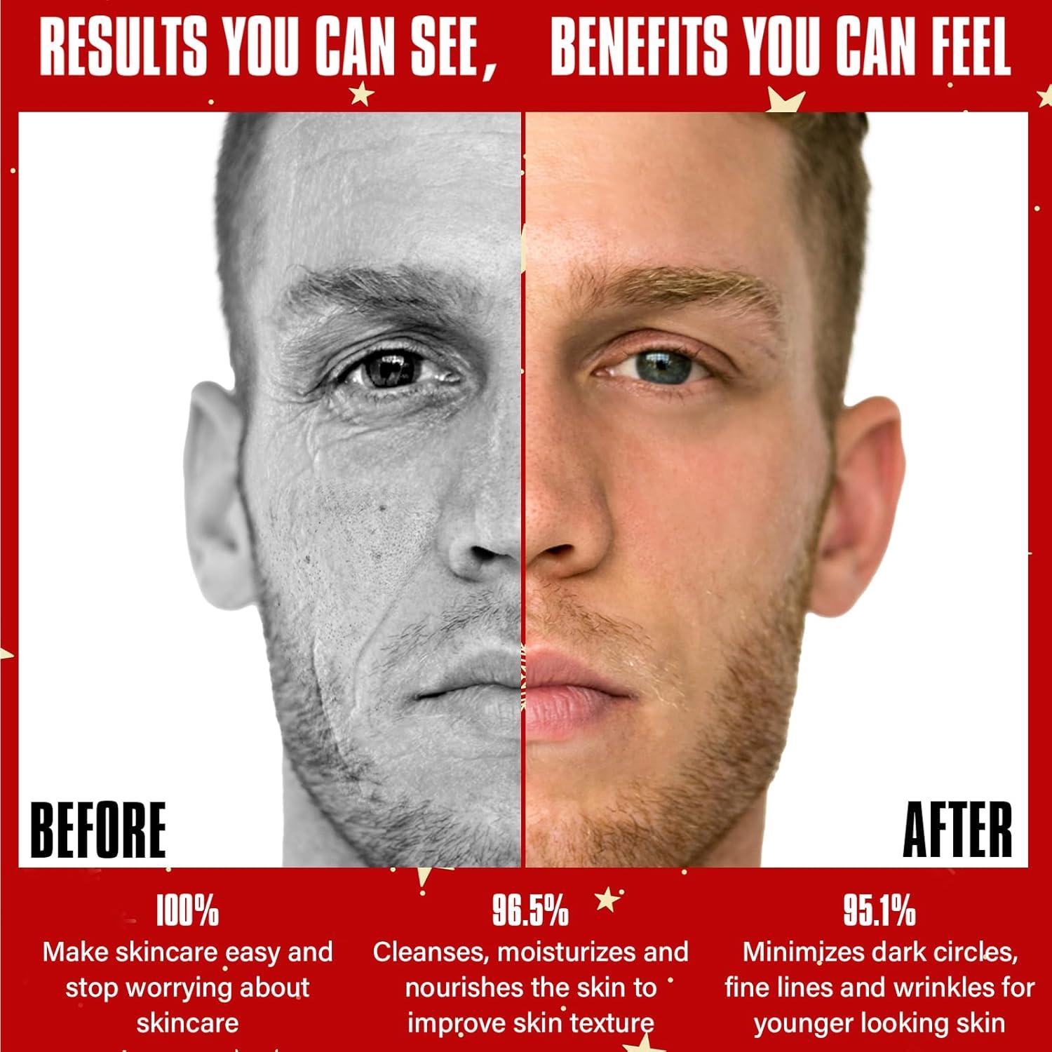 Kit de Cuidado Facial Anti-Envejecimiento Yealir 5 Piezas