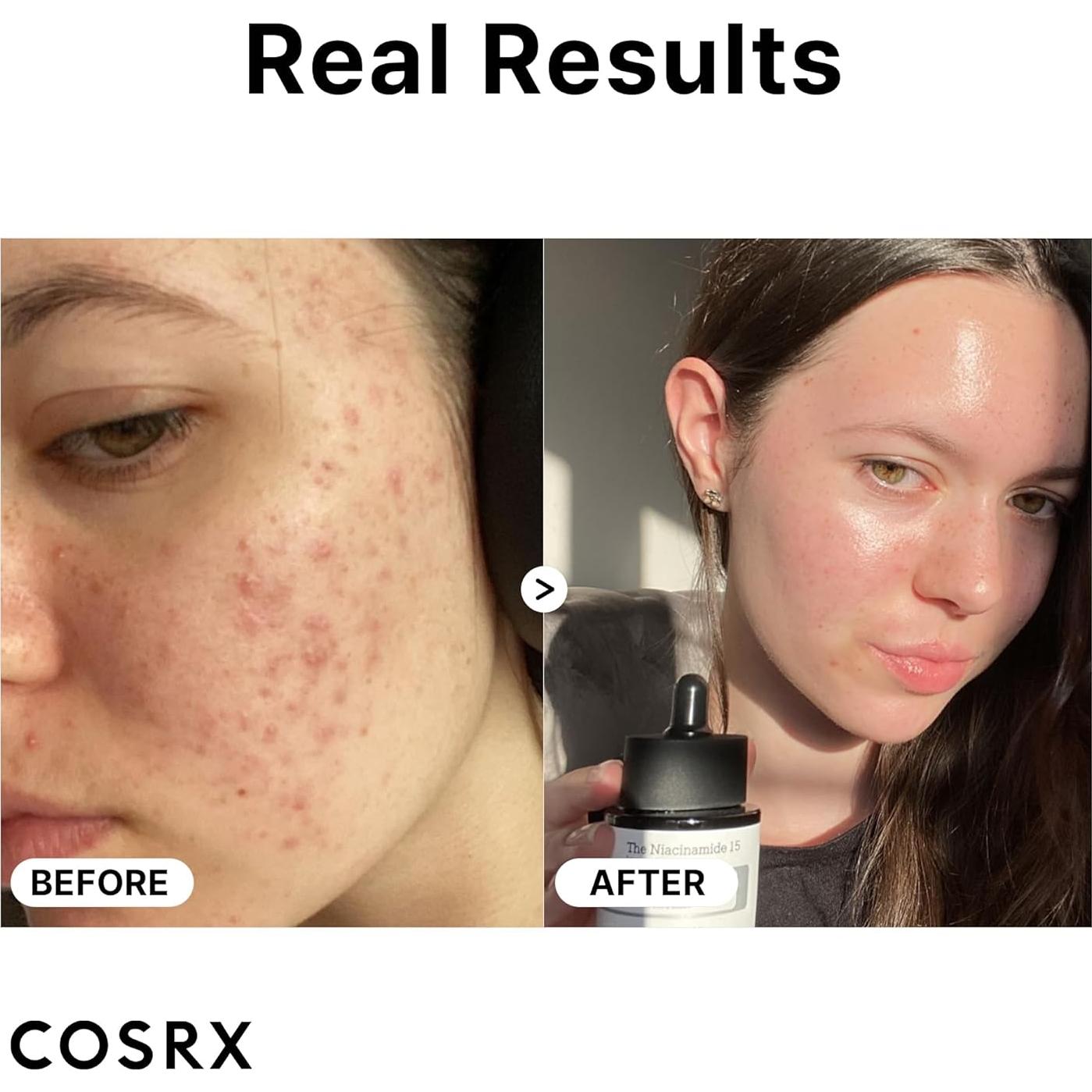 Suero Facial COSRX 2% Alfa Arbutina + 15% Niacinamida 30ml