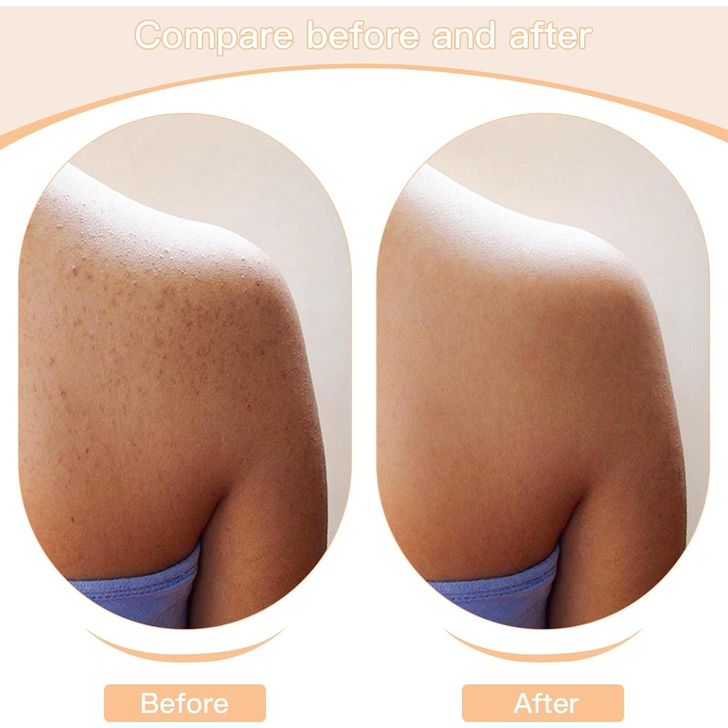 Paquete de 1 Cepillo Exfoliante Corporal de Madera - Drenaje Linfático