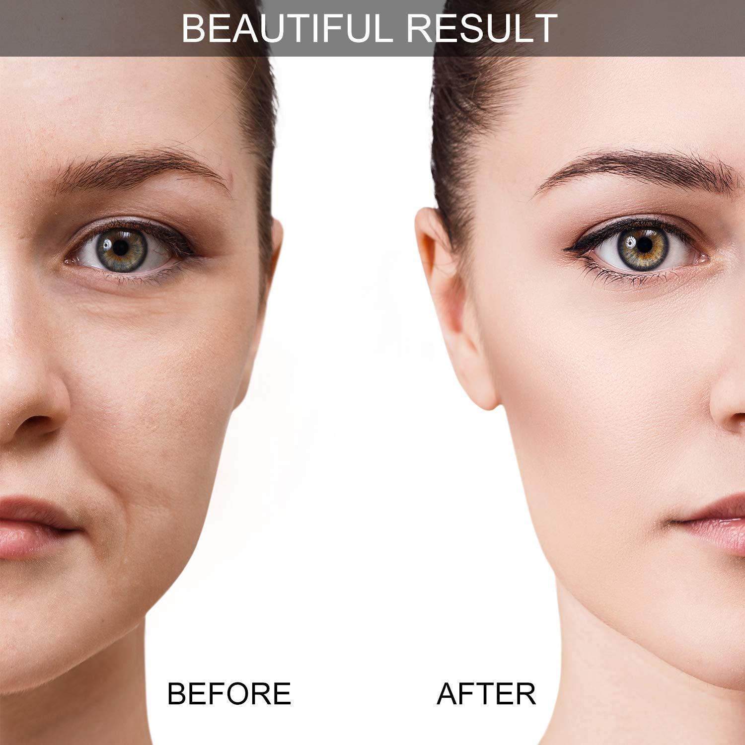 Kit de Ventosas Faciales BBTO de Silicona - 6 Piezas y Cepillo