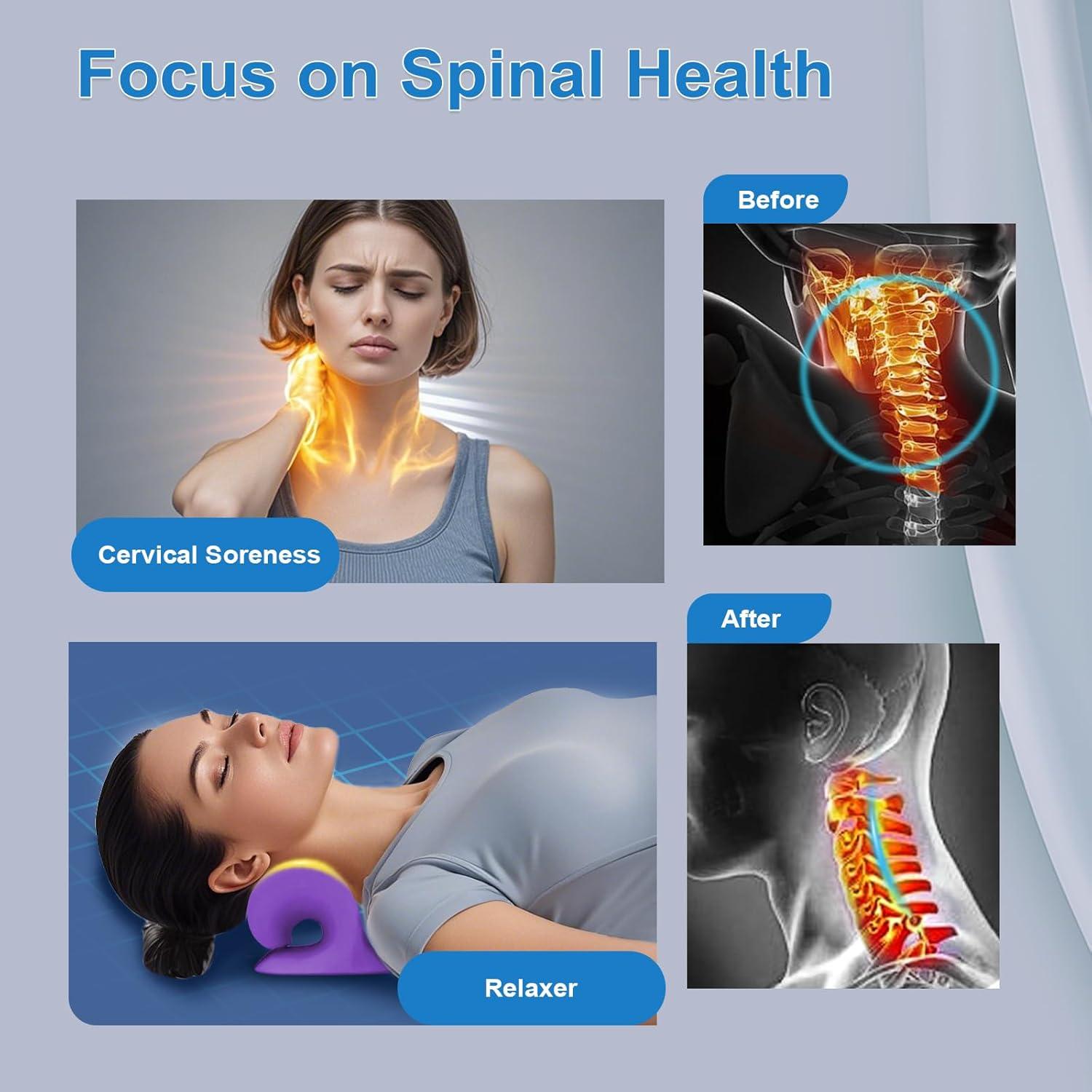 Estirador de Cuello YooYuan con Acupresión y Terapia Magnética