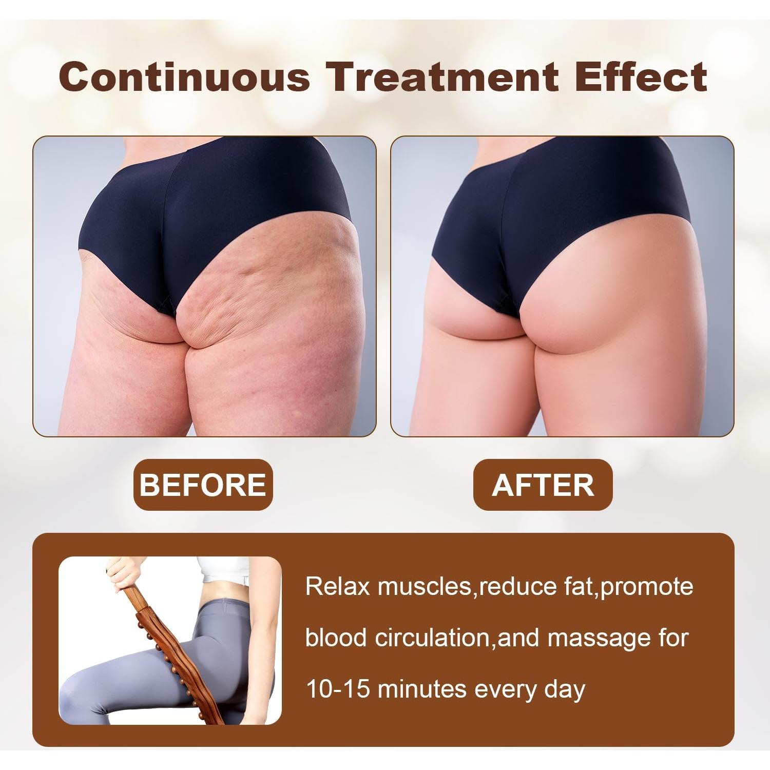 Bastón de Masaje de Madera para Drenaje Linfático 60 cm