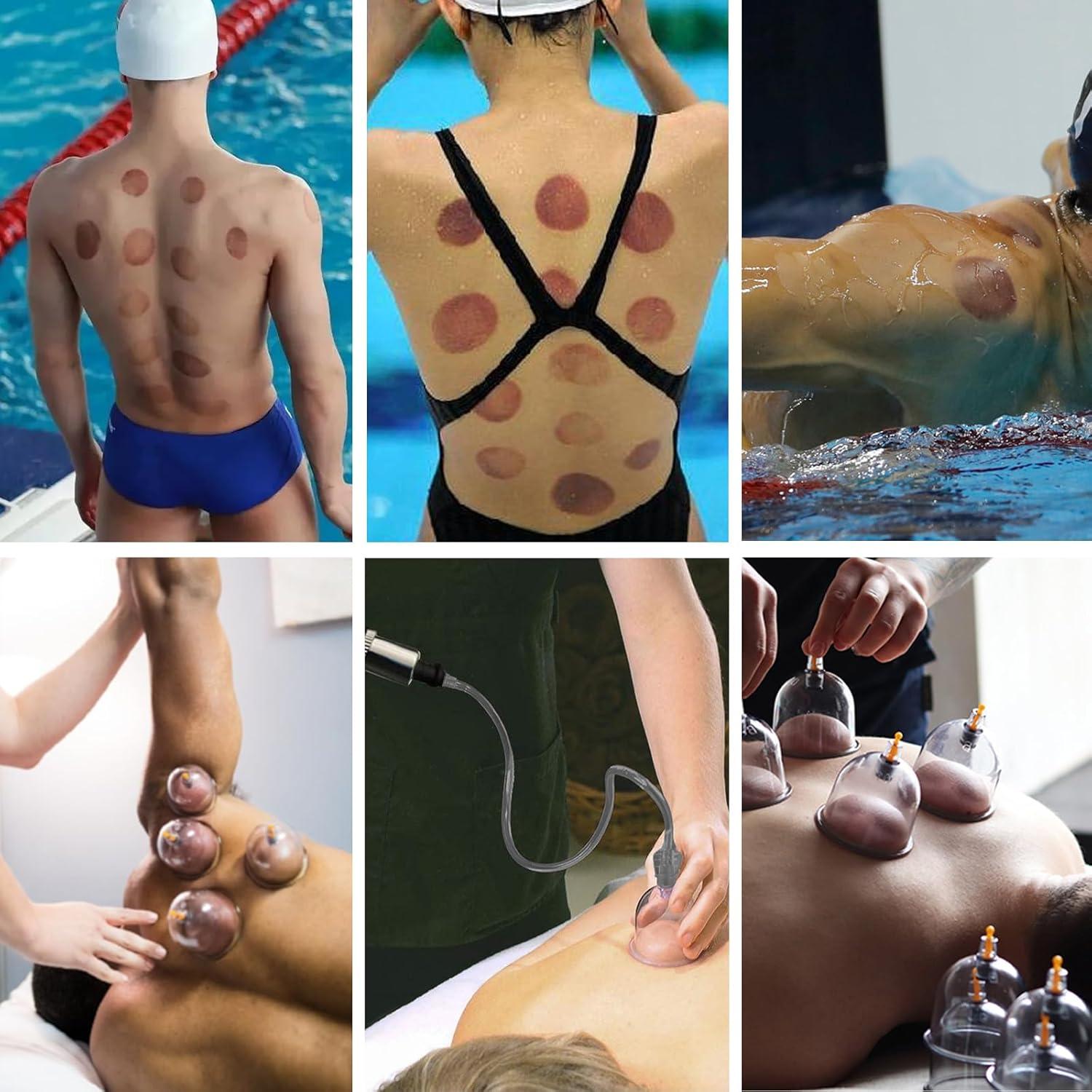 Kit de Ventosas DEFUNX 19 Tazas para Terapia de Masaje