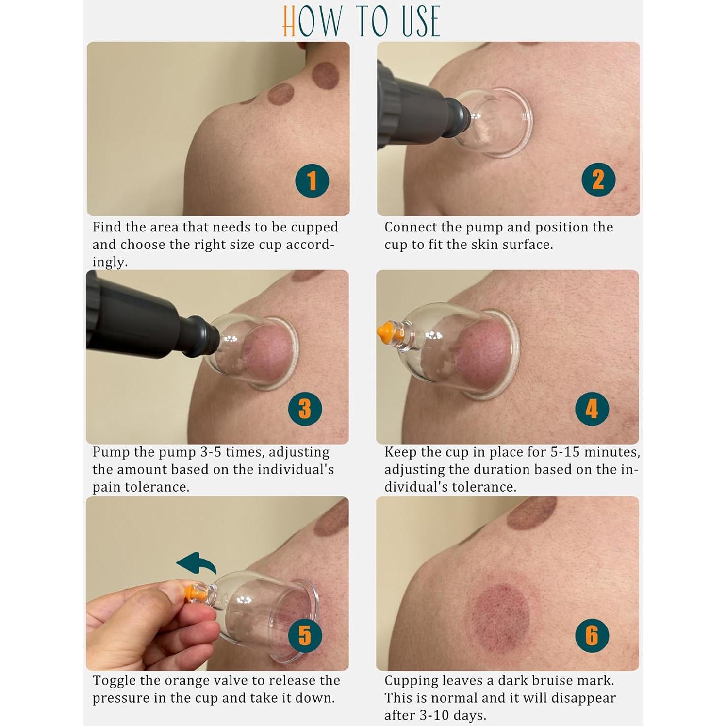 Juego de Ventosas de 12 Tazas DEFUNX para Masaje y Terapia