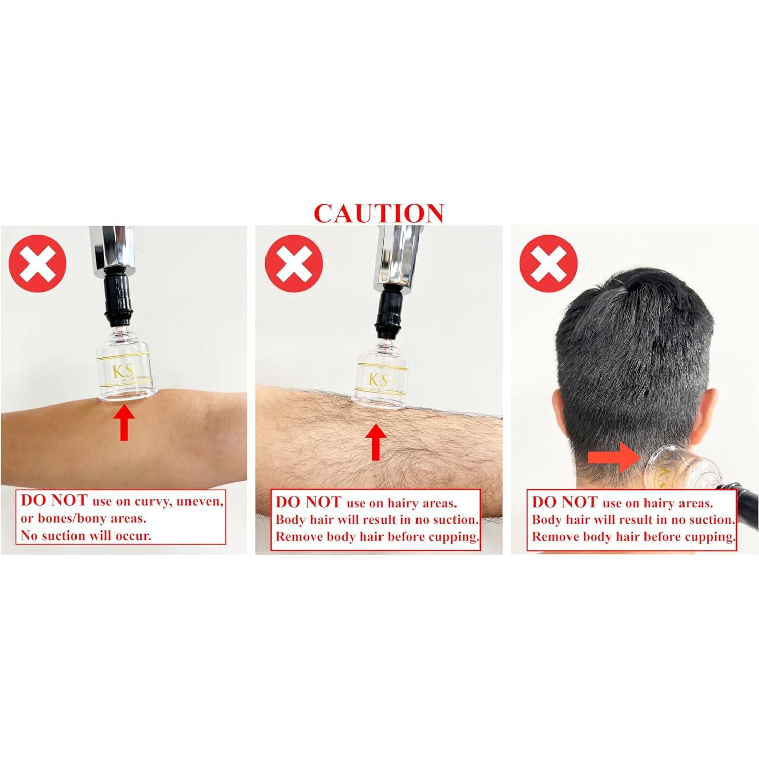 Juego de Ventosas Profesionales KS AG con Bomba y Tubo - 17 Piezas