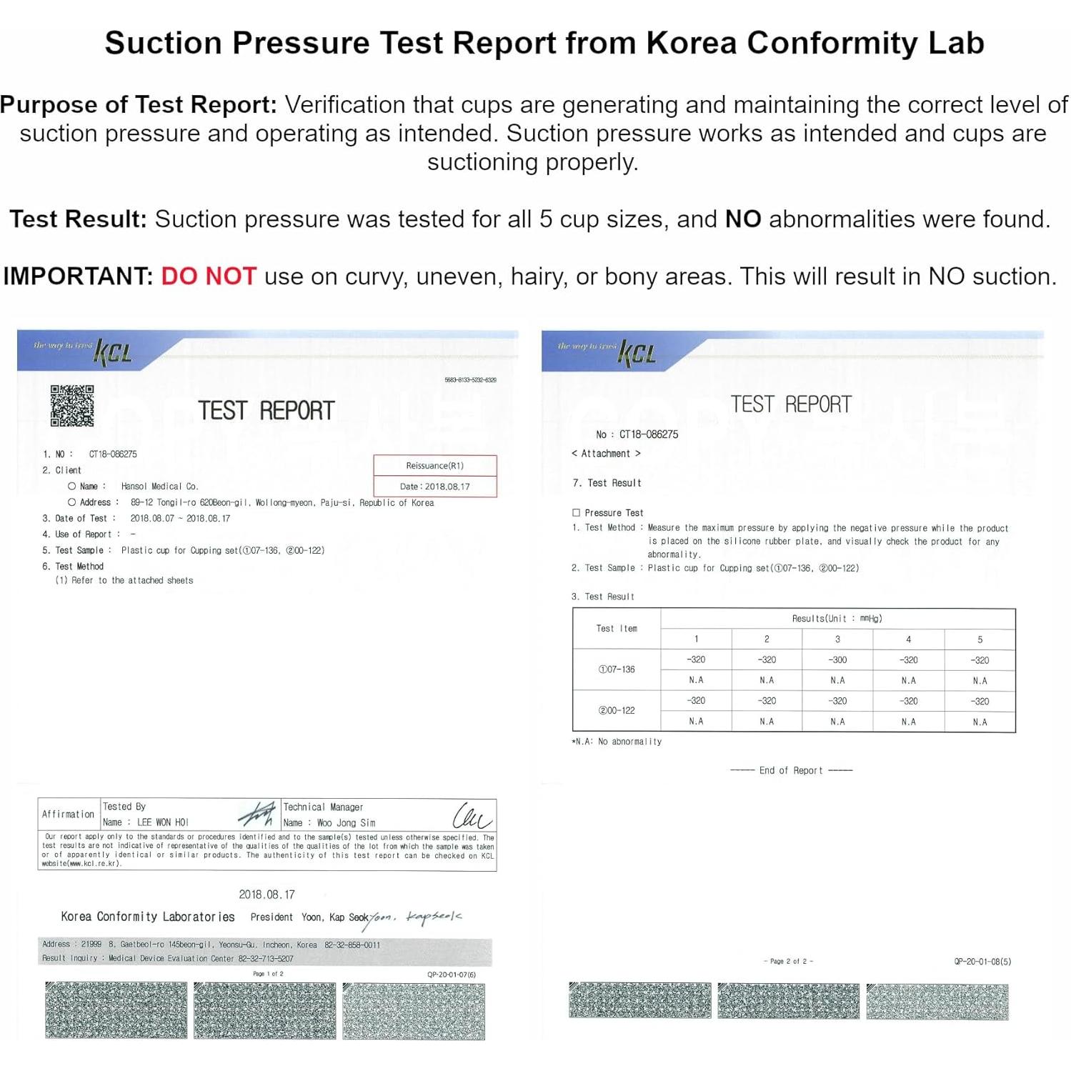 Juego de Ventosas Profesionales KS AG con Bomba y Tubo - 17 Piezas