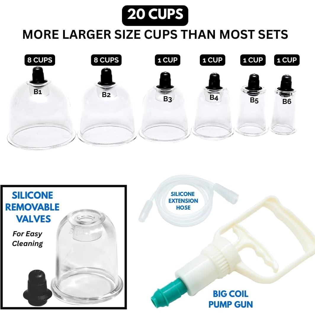 Juego de Ventosas de Terapia Profesional Cupping Warehouse - 20 Unidades