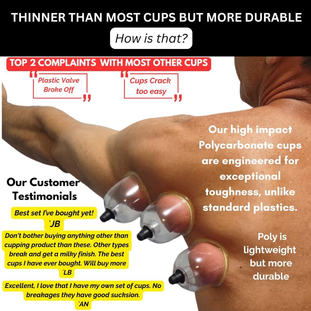 Juego de Ventosas de Terapia Profesional Cupping Warehouse - 20 Unidades