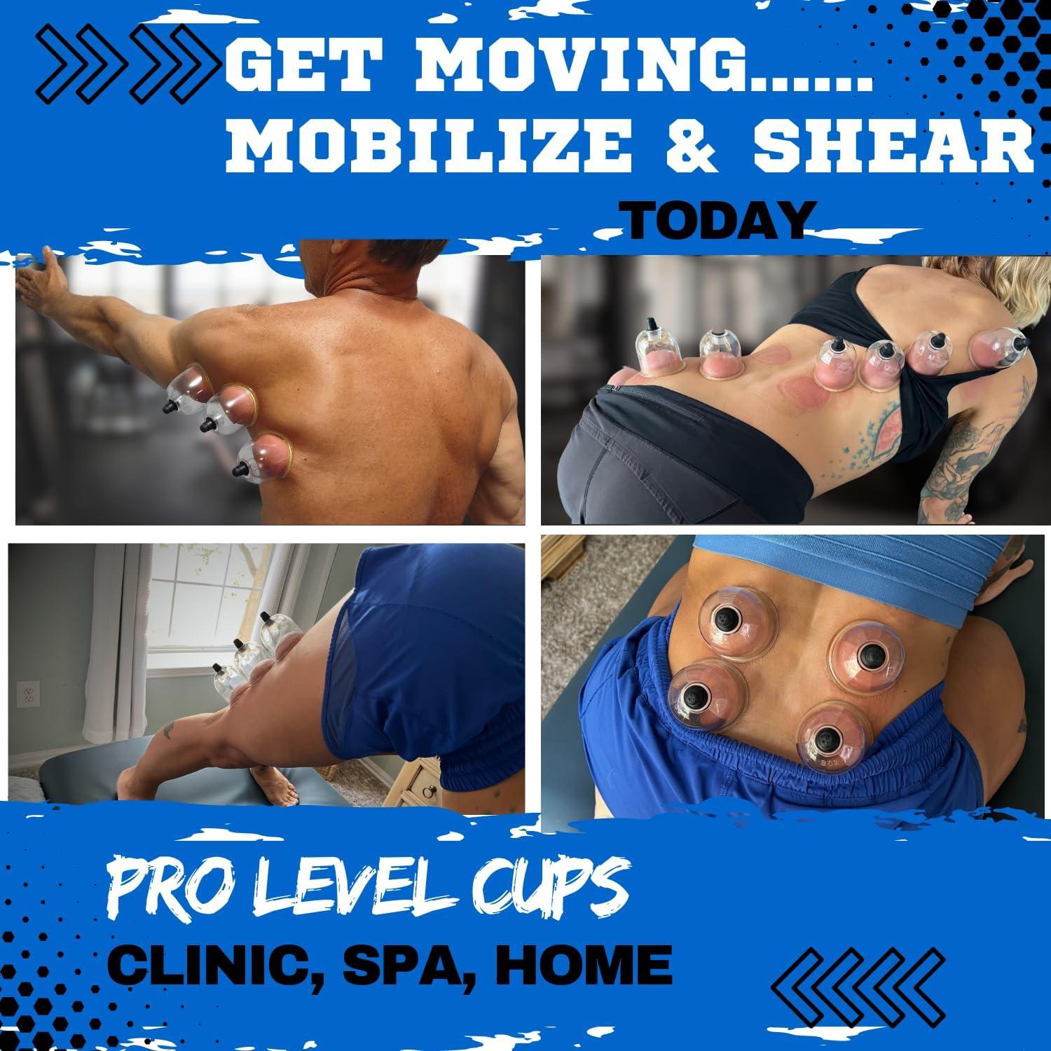 Juego de Ventosas de Terapia Profesional Cupping Warehouse - 20 Unidades